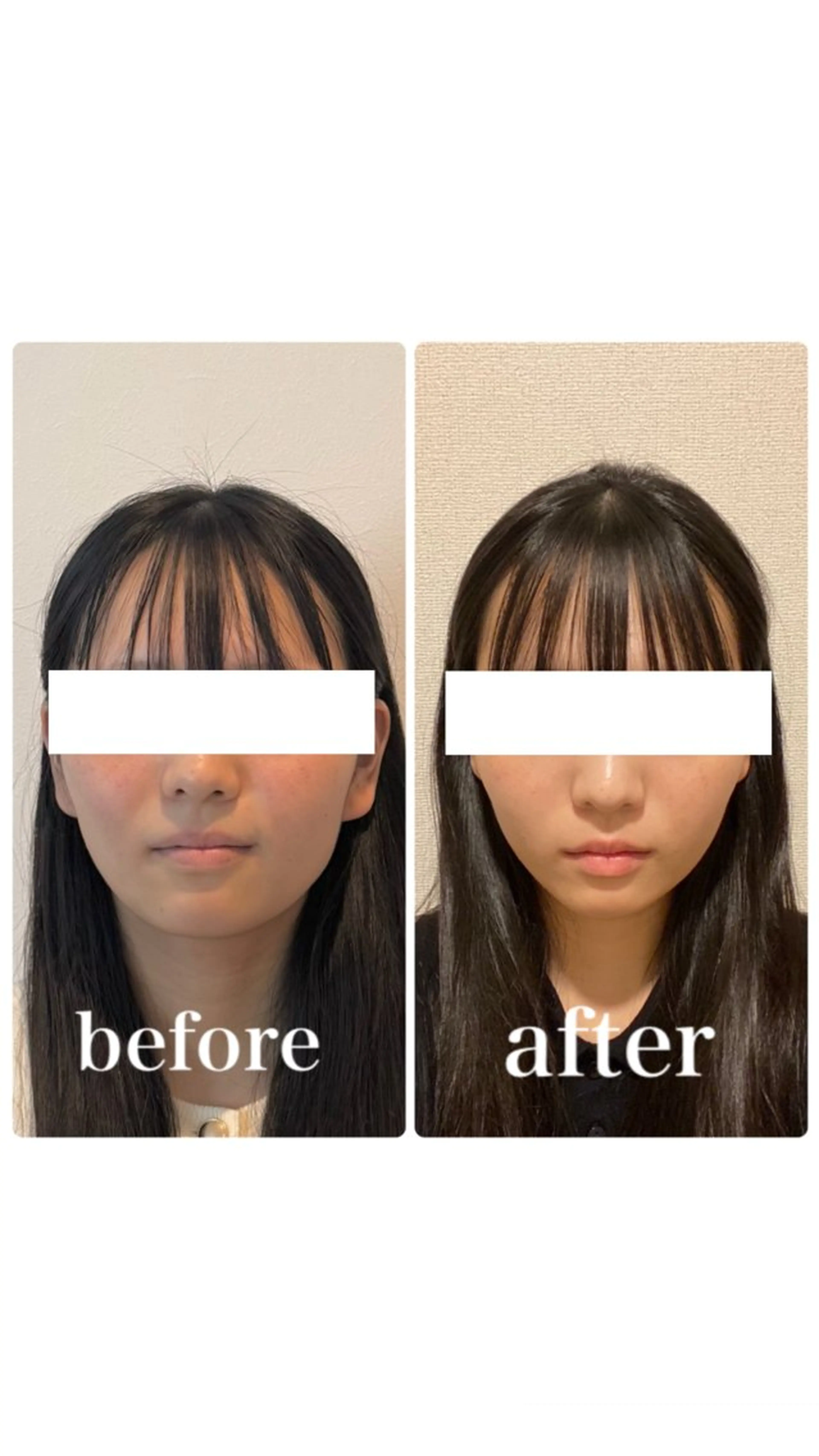 エステ リラク 小顔と ヘッドスパのお店のエステ・リラクイメージ