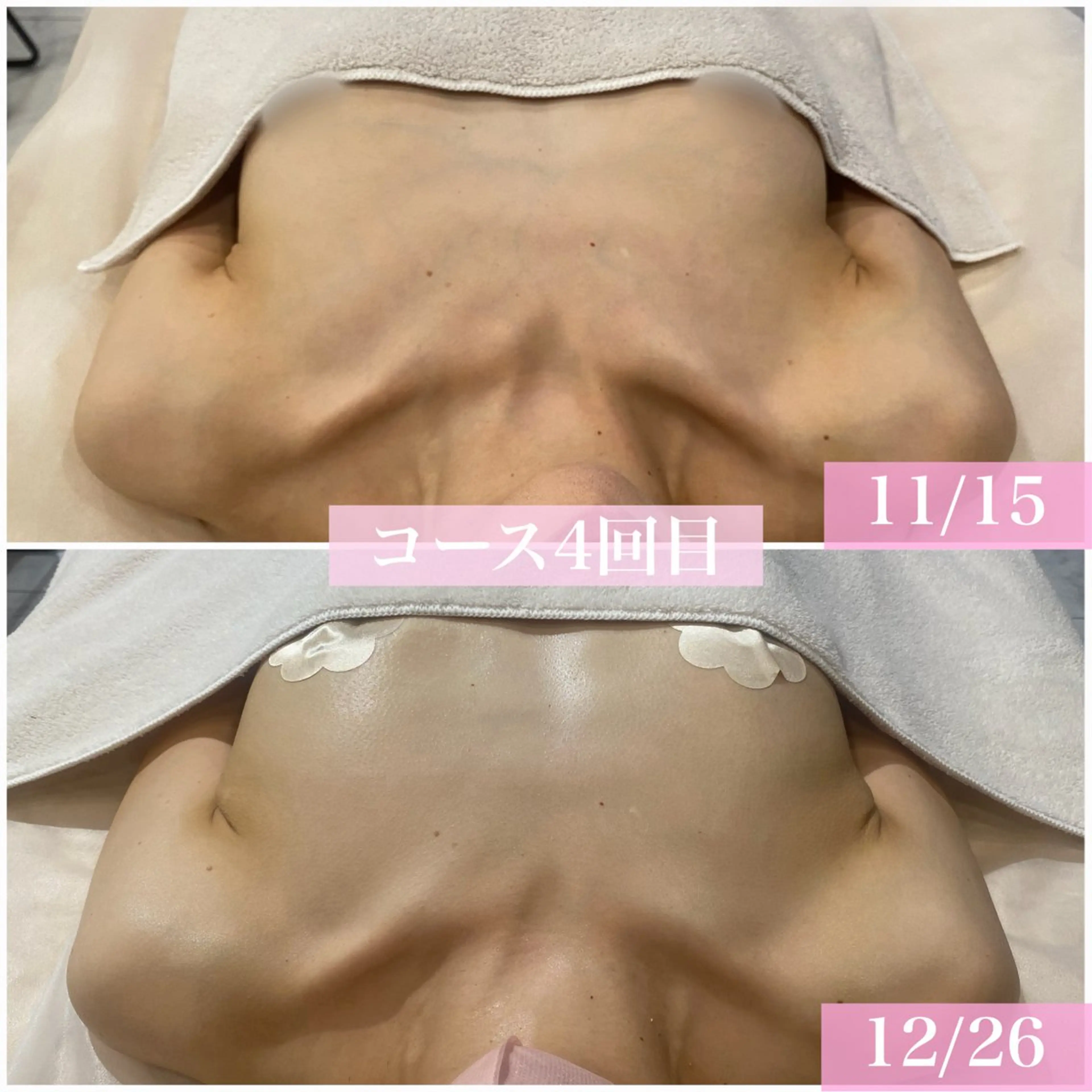 バストアップ専門店Lunalia Lux所属・LUNARIA LUX 佐藤 ゆきみのエステ・リラクイメージ