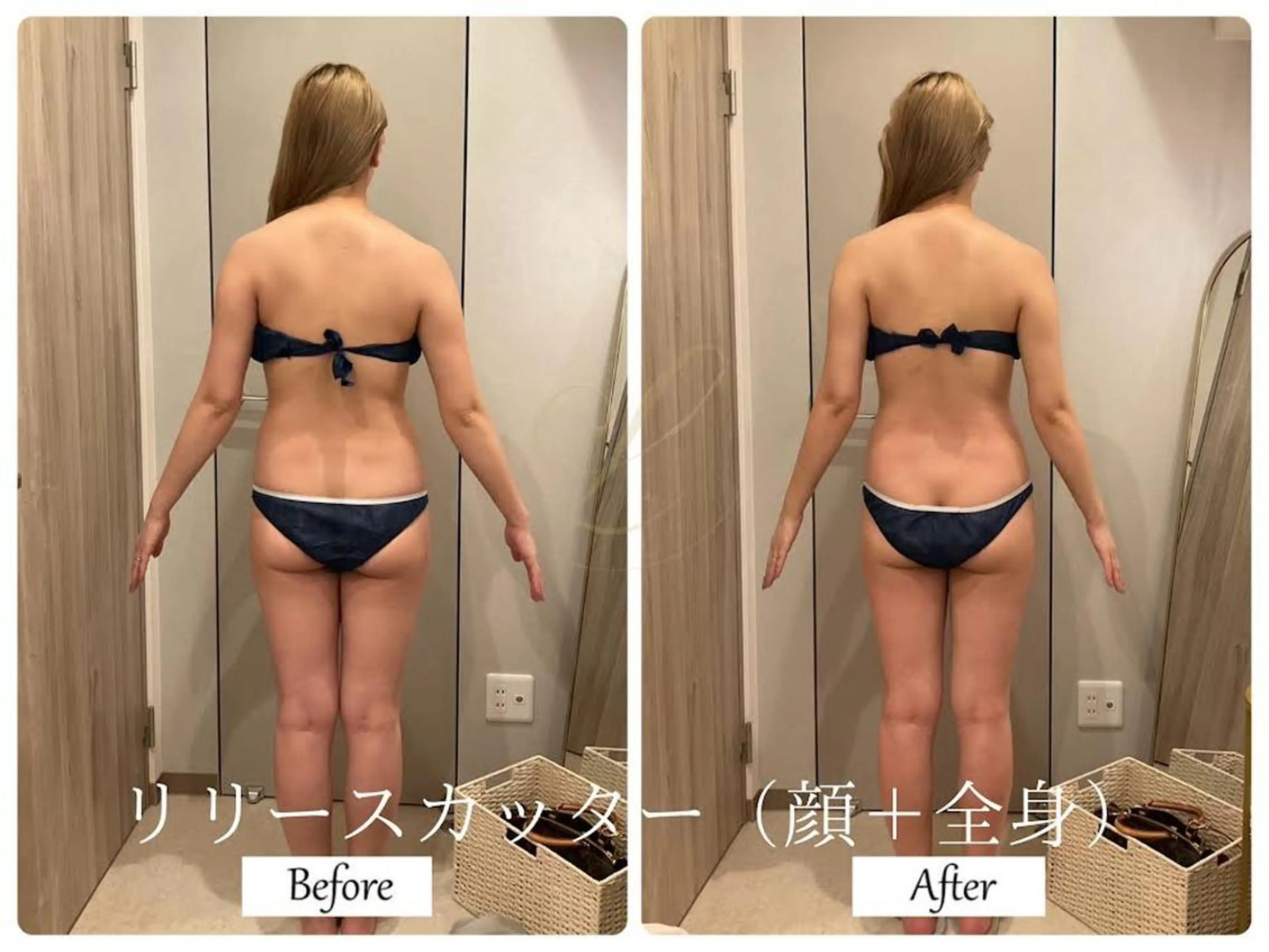 エステ リラク ブライダルサロン ｜Lino【堀江】のエステ・リラクイメージ