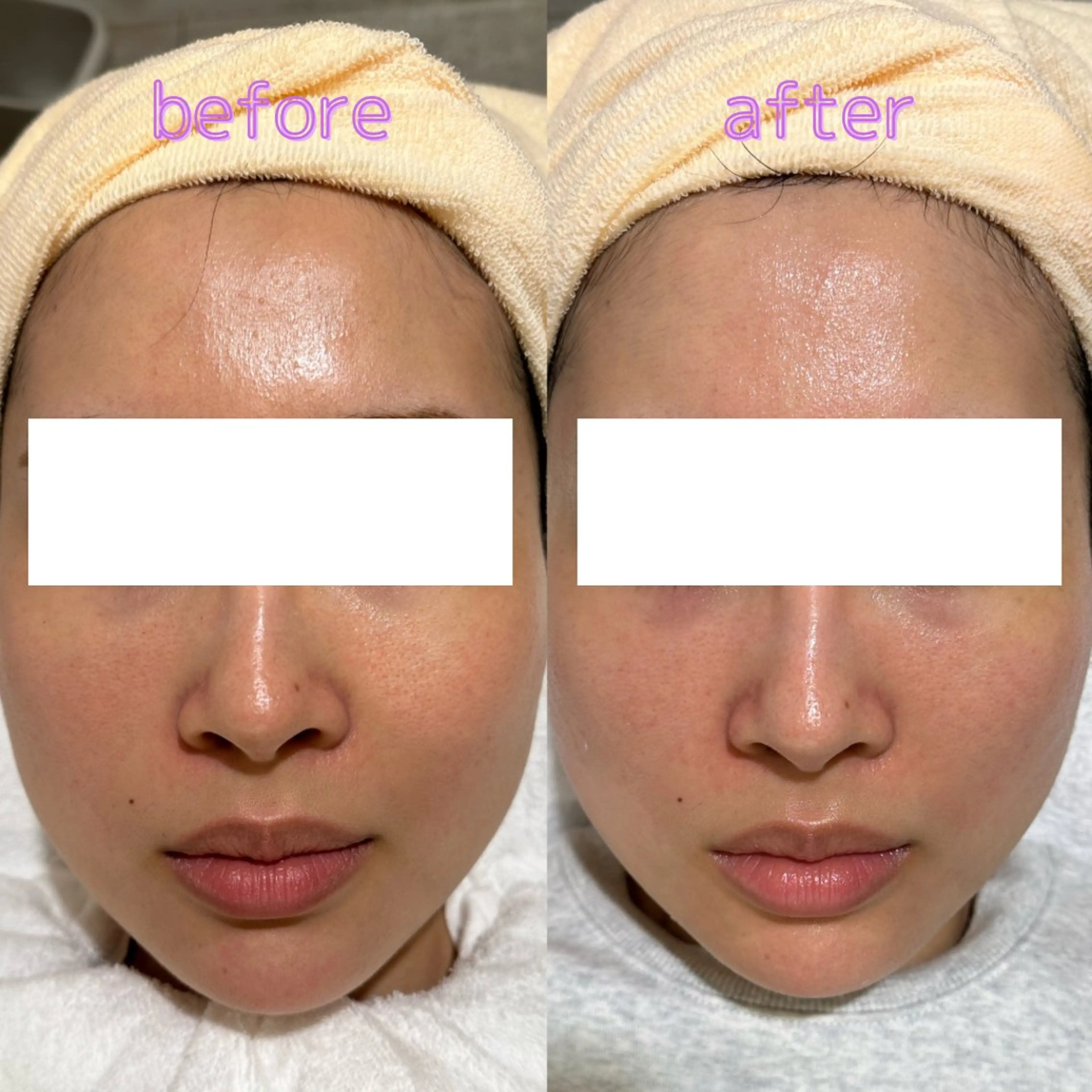 pansy(パンジー)上野フェイシャルエステ専門店所属・pansy saraのエステ・リラクイメージ