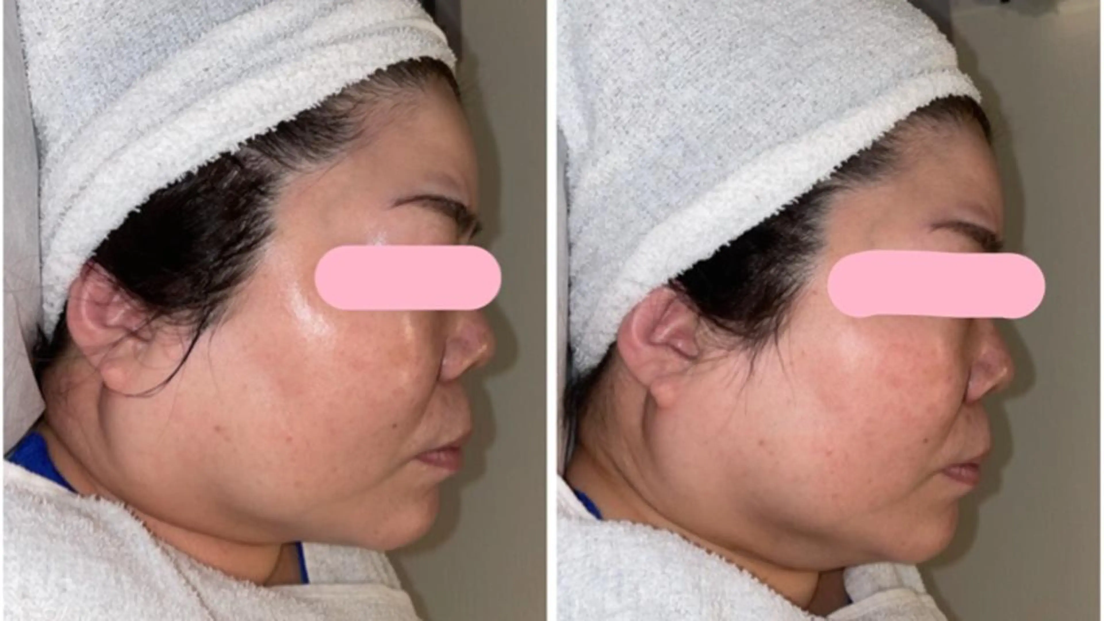 lady's&men's　beauty salon s.i.d所属・ビューティーサロン s.i.d深井店のエステ・リラクイメージ