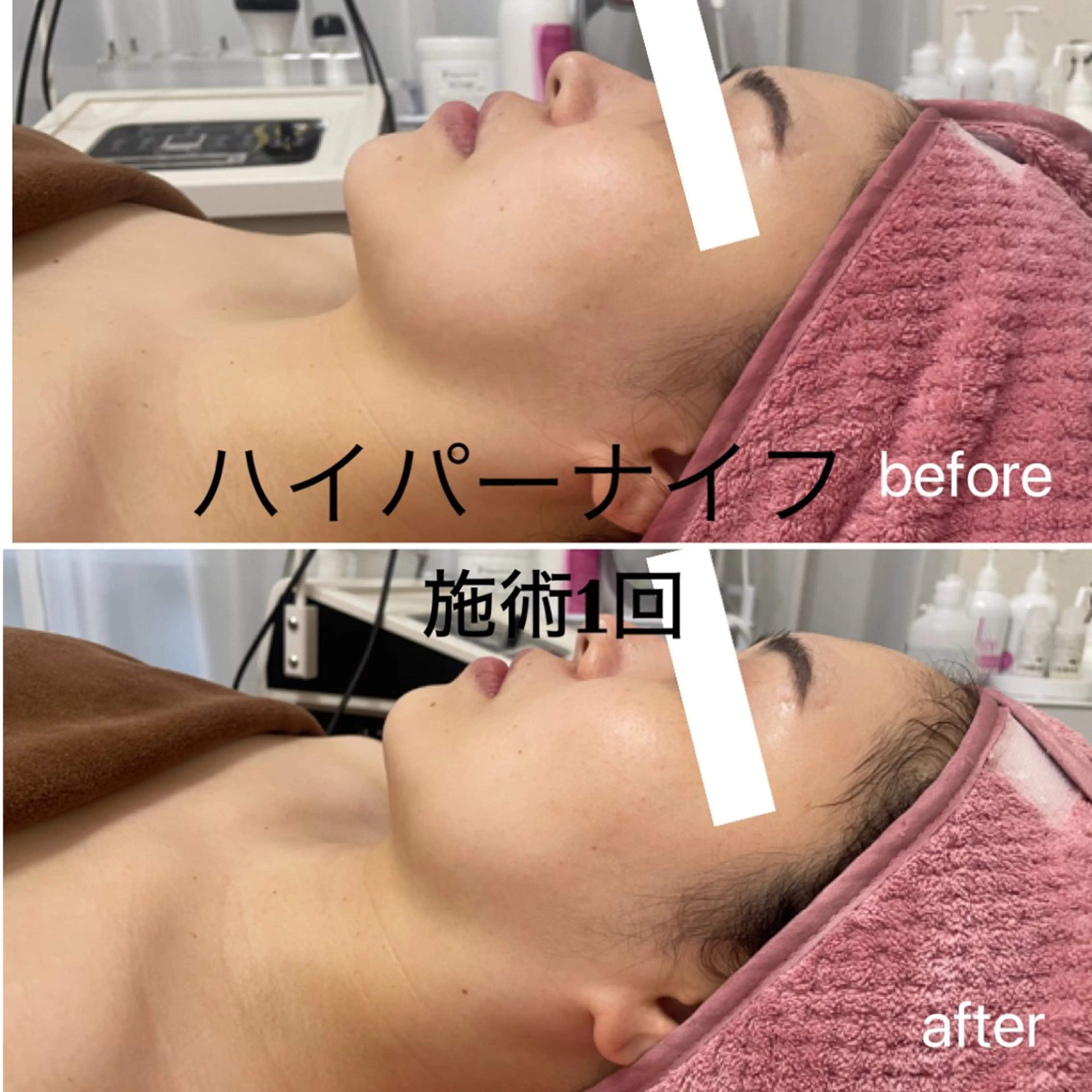 エステ リラク le verre久屋公園所属・le verre 久屋公園のネイルデザイン