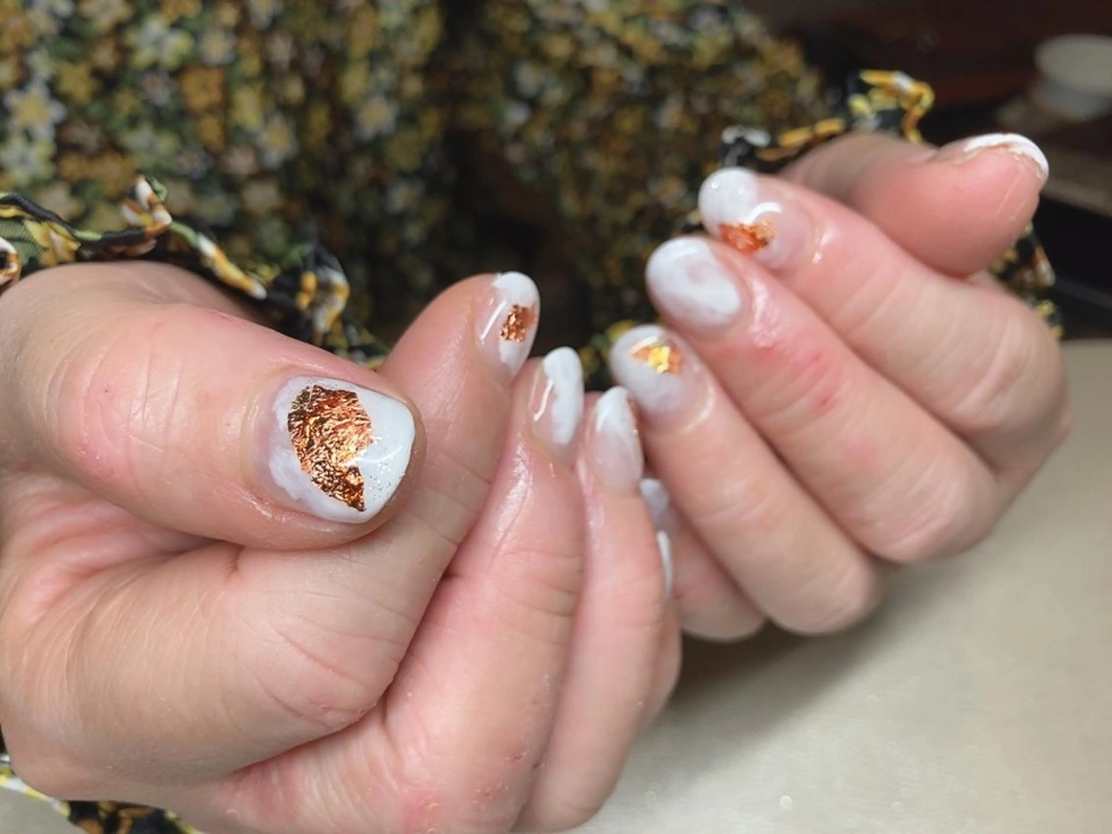 ネイル 𝐴𝑁𝑈𝐸 トラブル爪育成専門のネイルデザイン