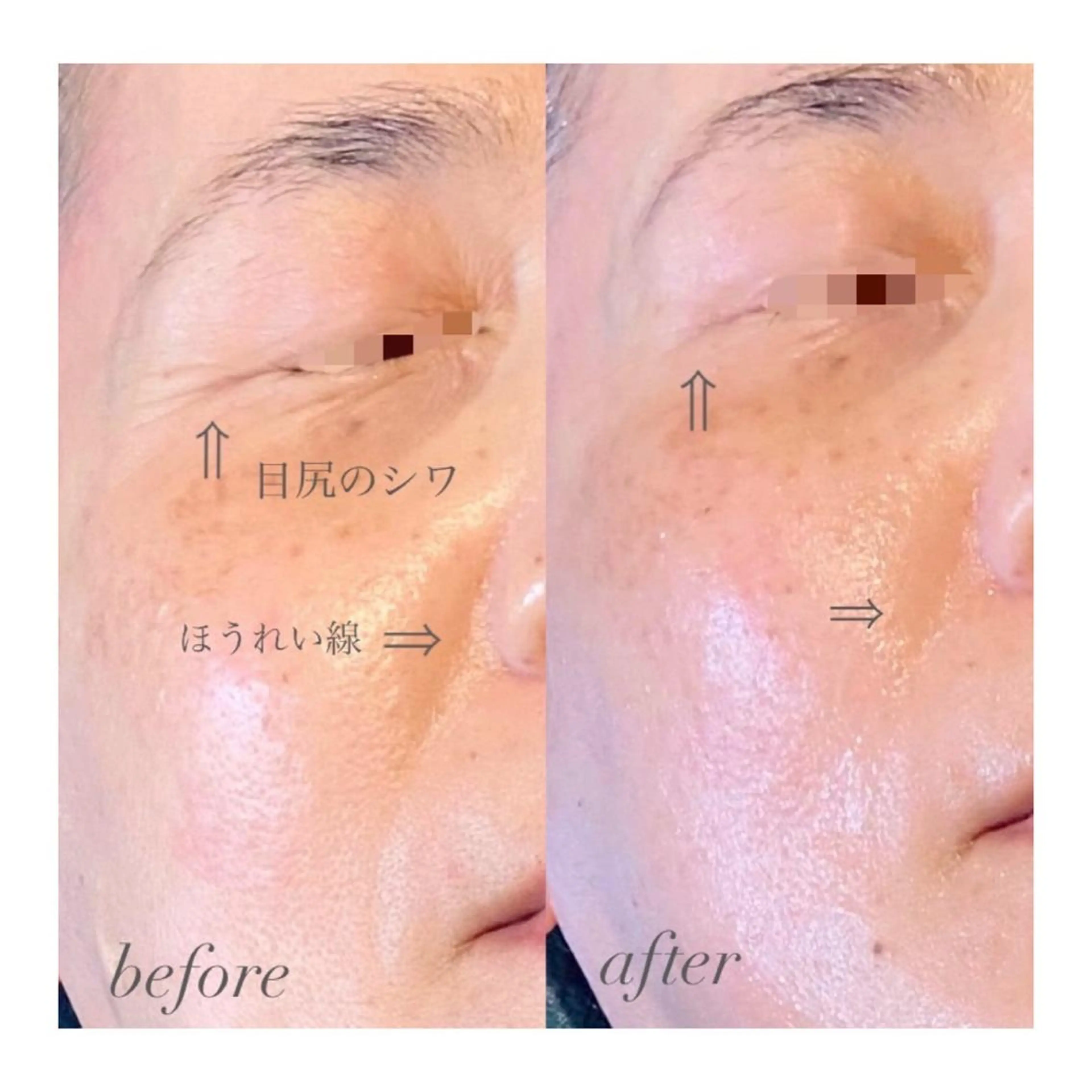 UnderGarden hair&spa所属・朴月香@Under Garden🌿‬のエステ・リラクイメージ