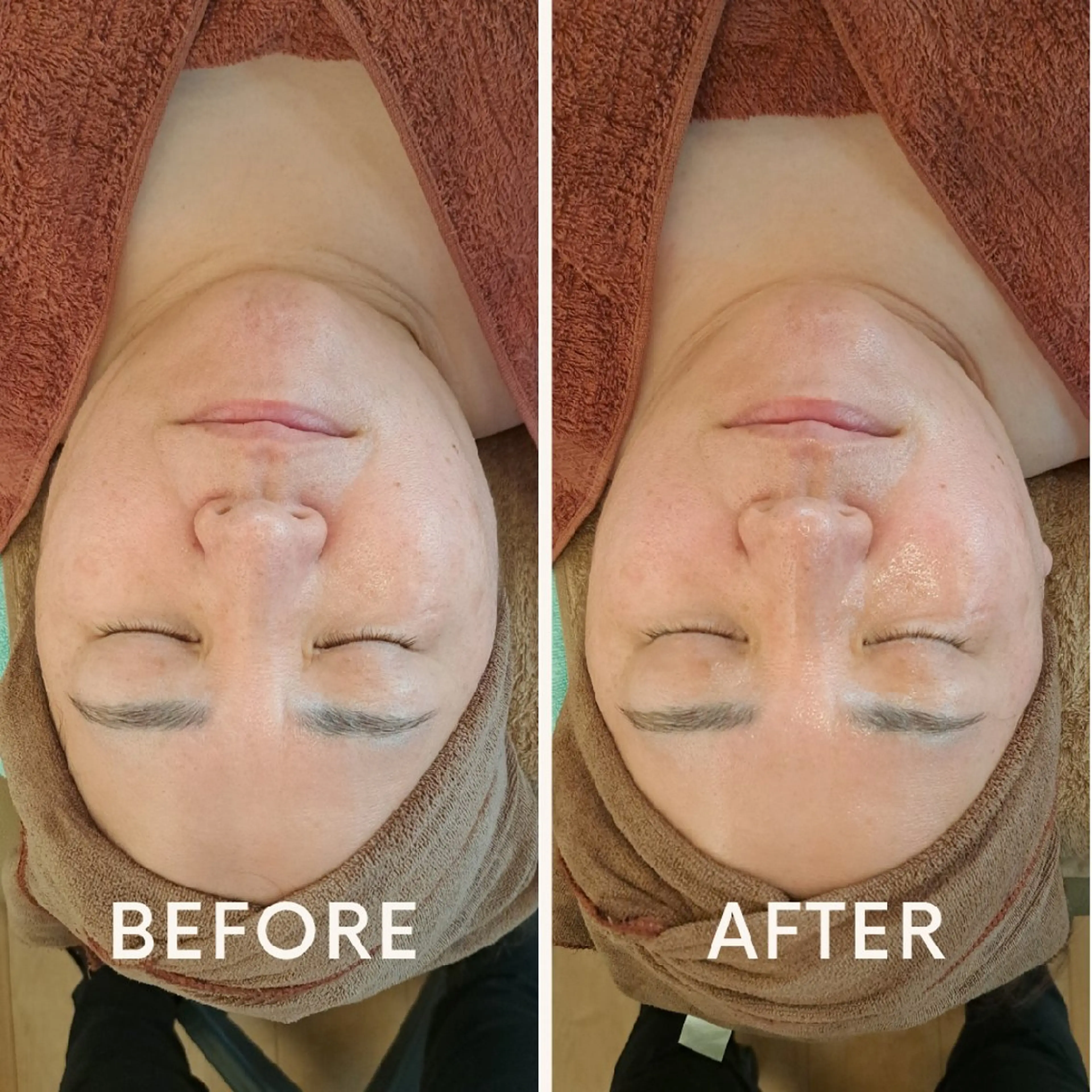 鍼灸サロンmiyabi所属・美容鍼×エステ　鍼灸 サロンmiyabiのエステ・リラクイメージ