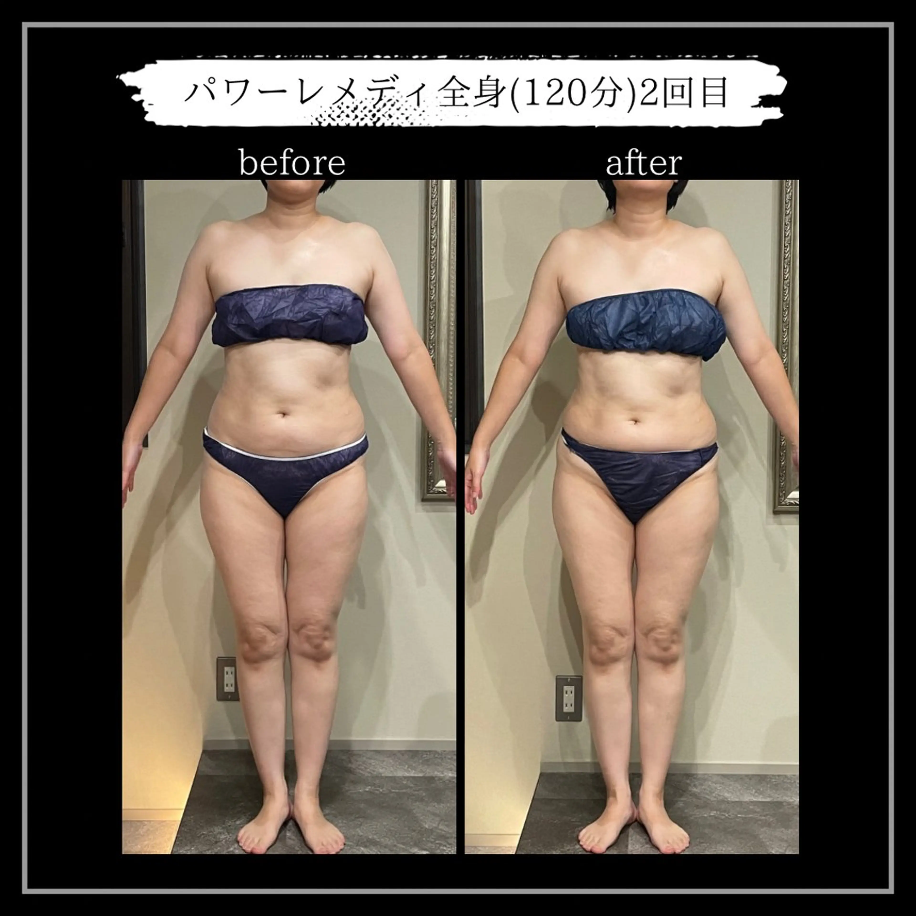 オフ:オン所属・オフ:オン 全身筋膜マッサージのエステ・リラクイメージ