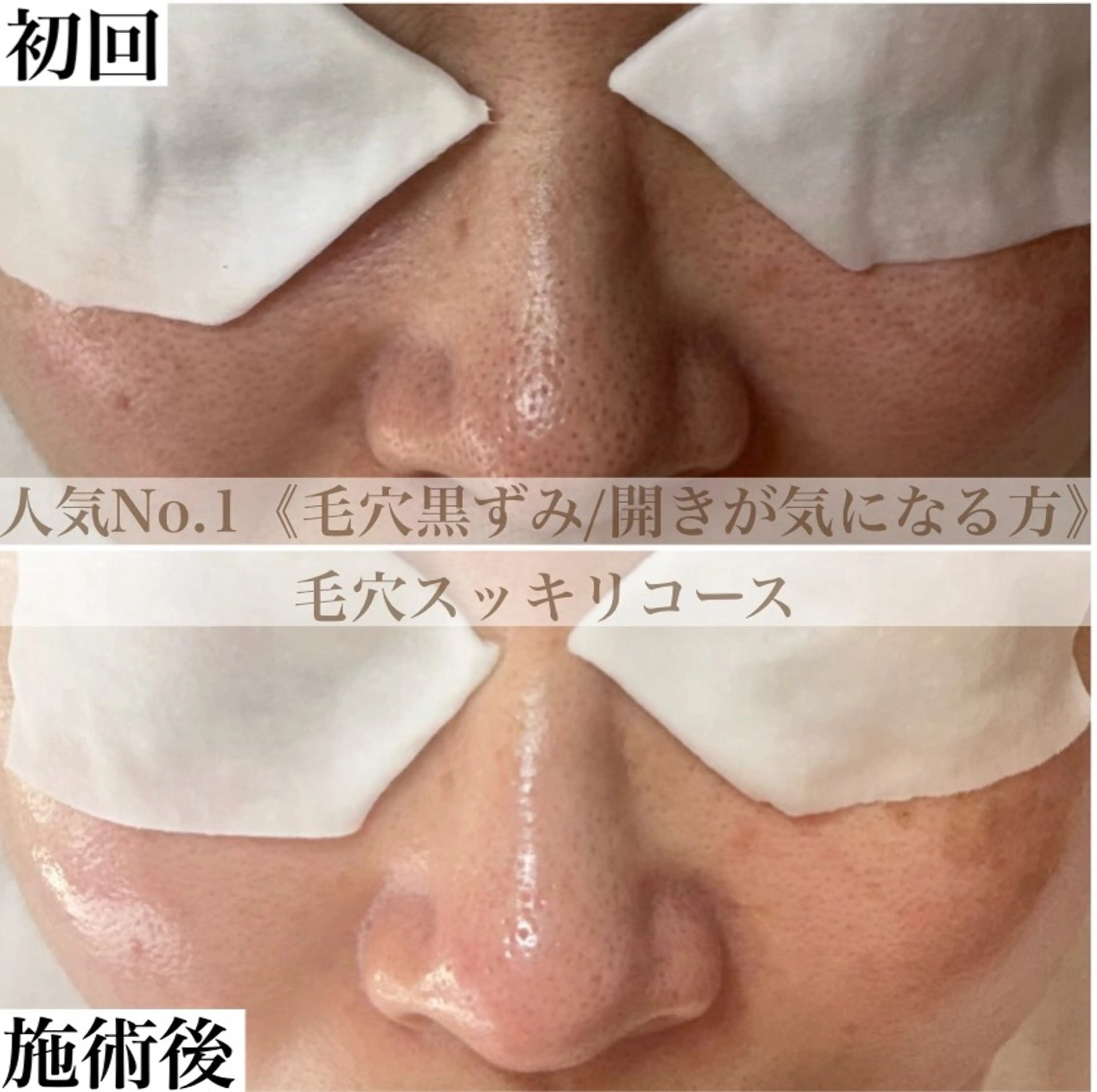 BEAUTY SALON BeLL所属・毛穴ケア専門店 BeLL ベルのエステ・リラクイメージ