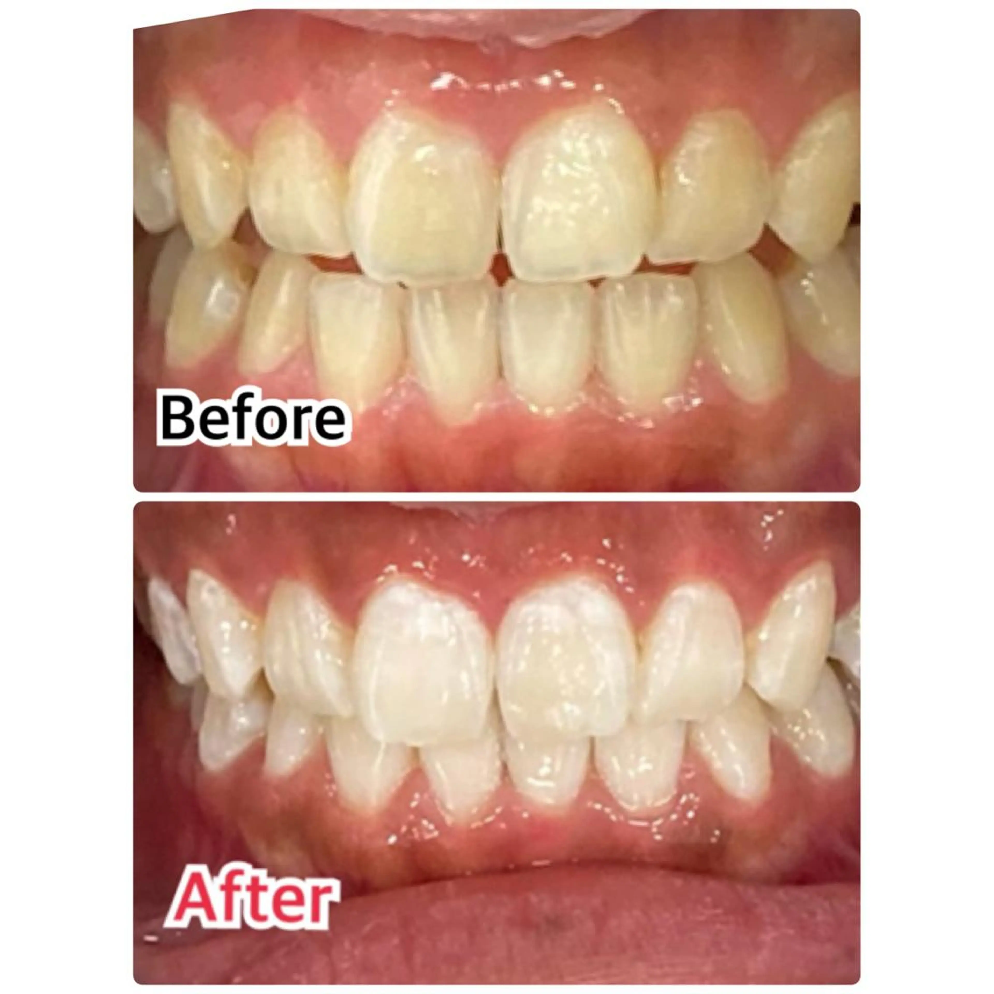 その他 プラチナムビューティー柏所属・【歯科提携】柏ホワイ トニングスタイルのその他イメージ