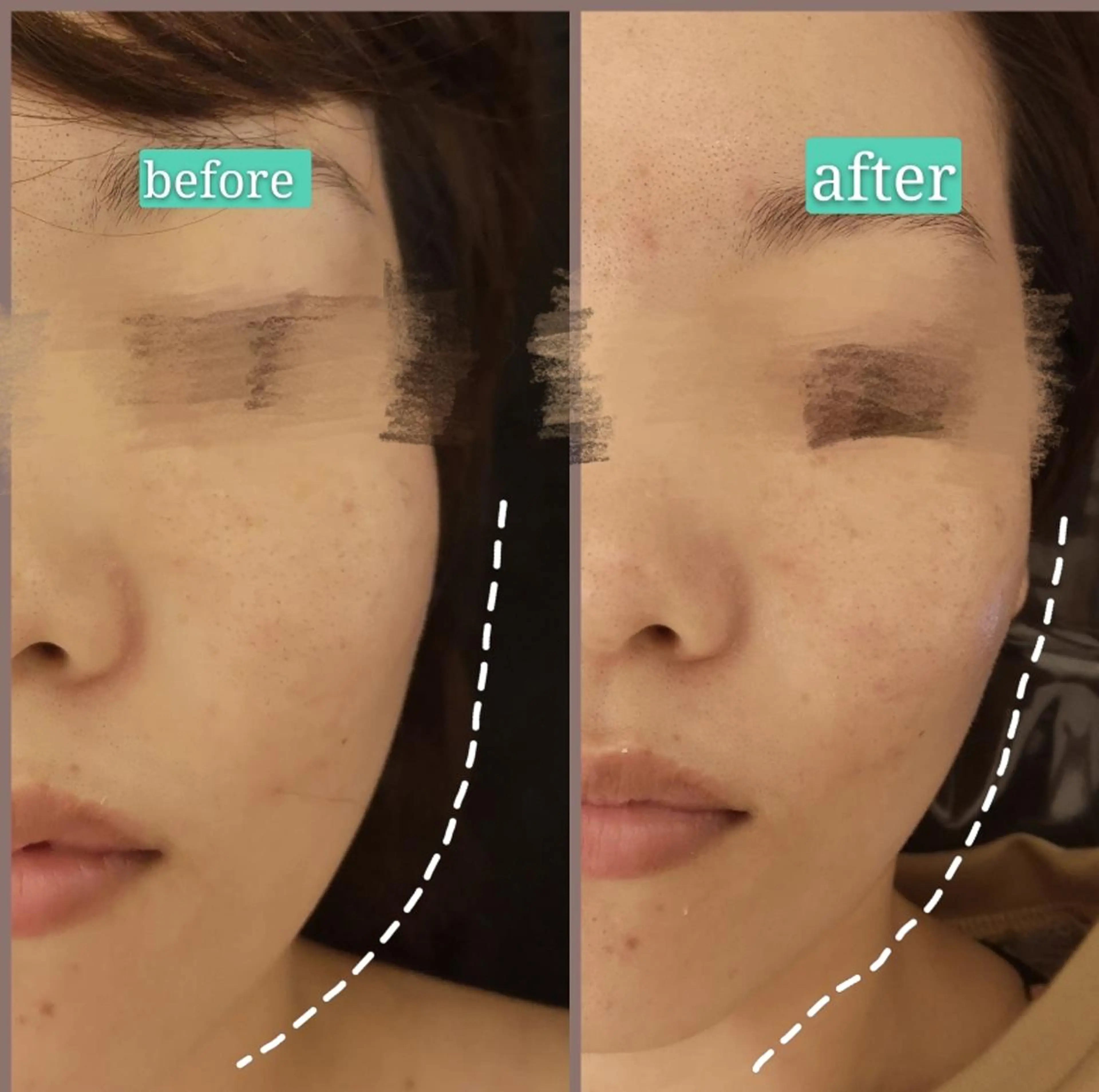 🅖🅤🅩🅔🅛 salonのエステ・リラクイメージ