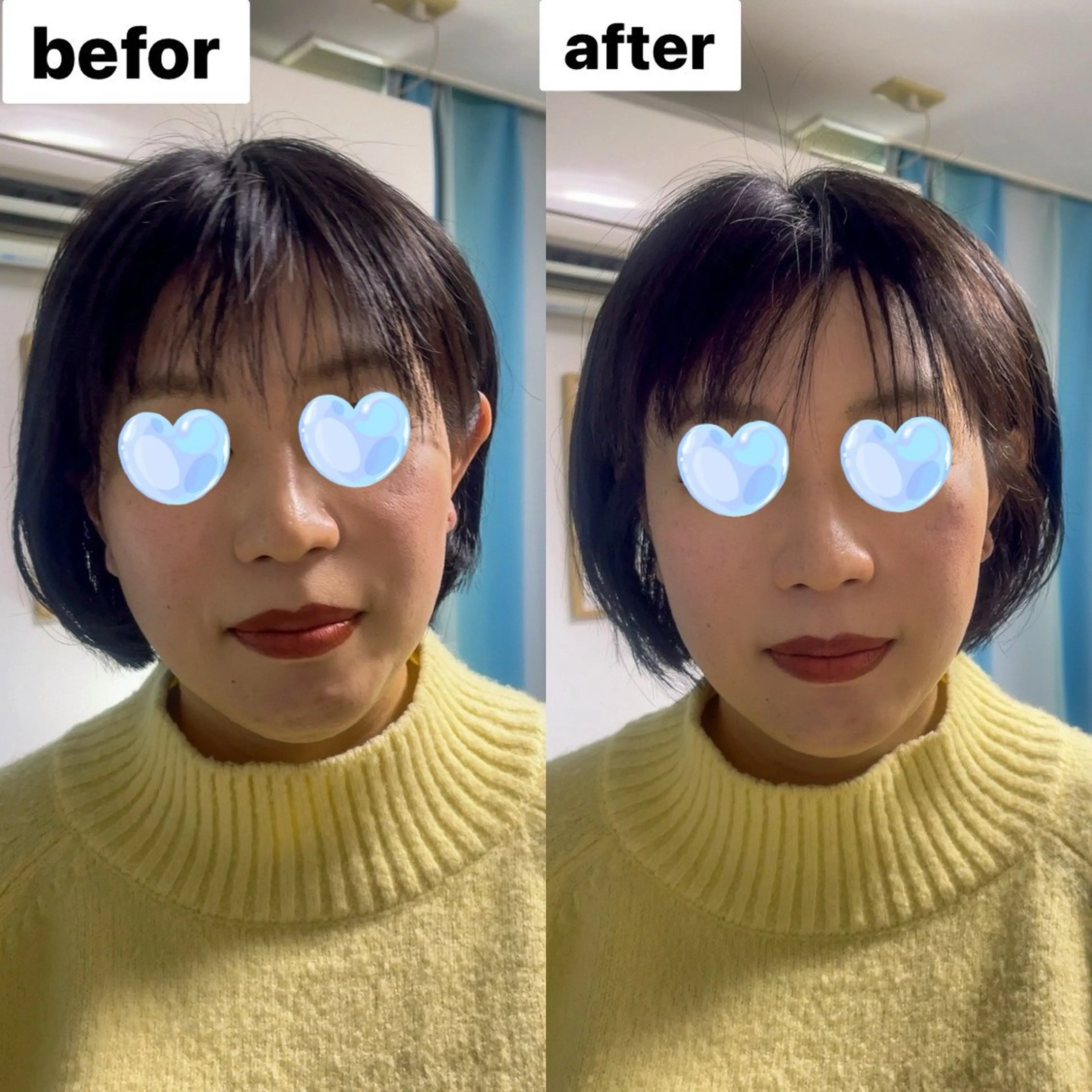 💆‍♀️【15分】クイック小顔ドライヘッドスパの写真