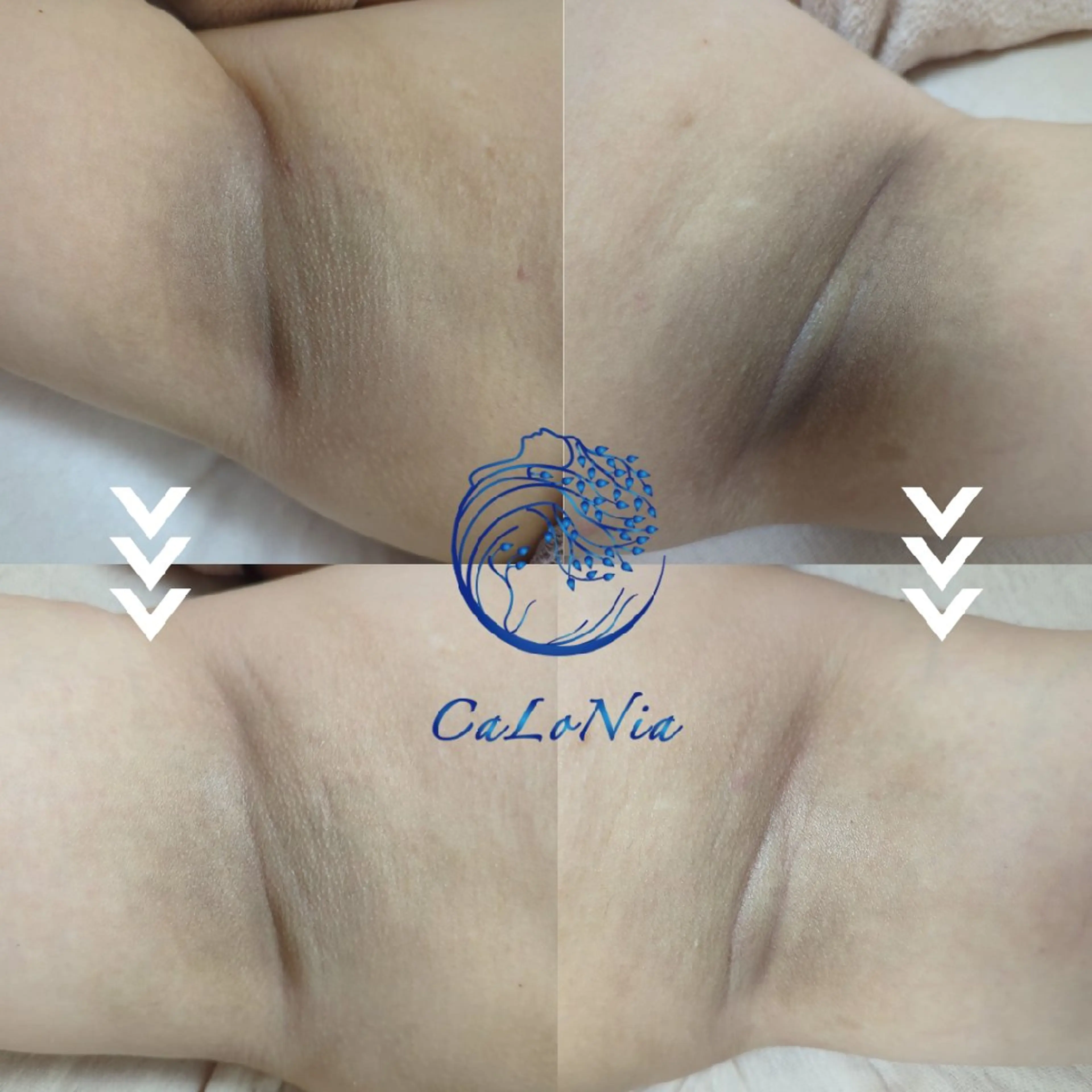 肌質改善・艶髪サロン CaLoNiaのエステ・リラクイメージ