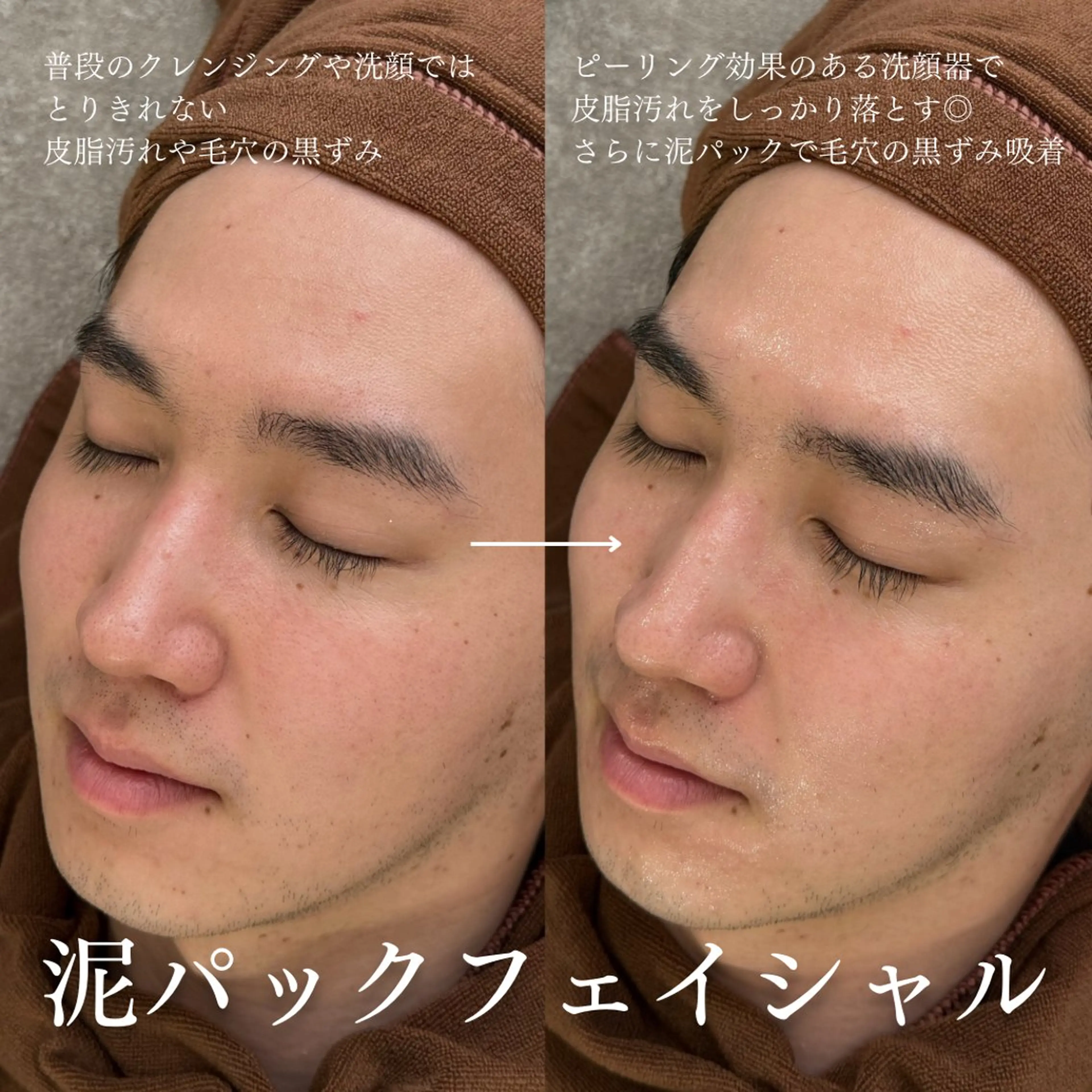 メンズ エステ 眉毛専門サロンeight（エイト）大阪心斎橋所属・メンズ眉/顔ワックス ☀️しおり🌙の眉毛・アイブロウイメージ