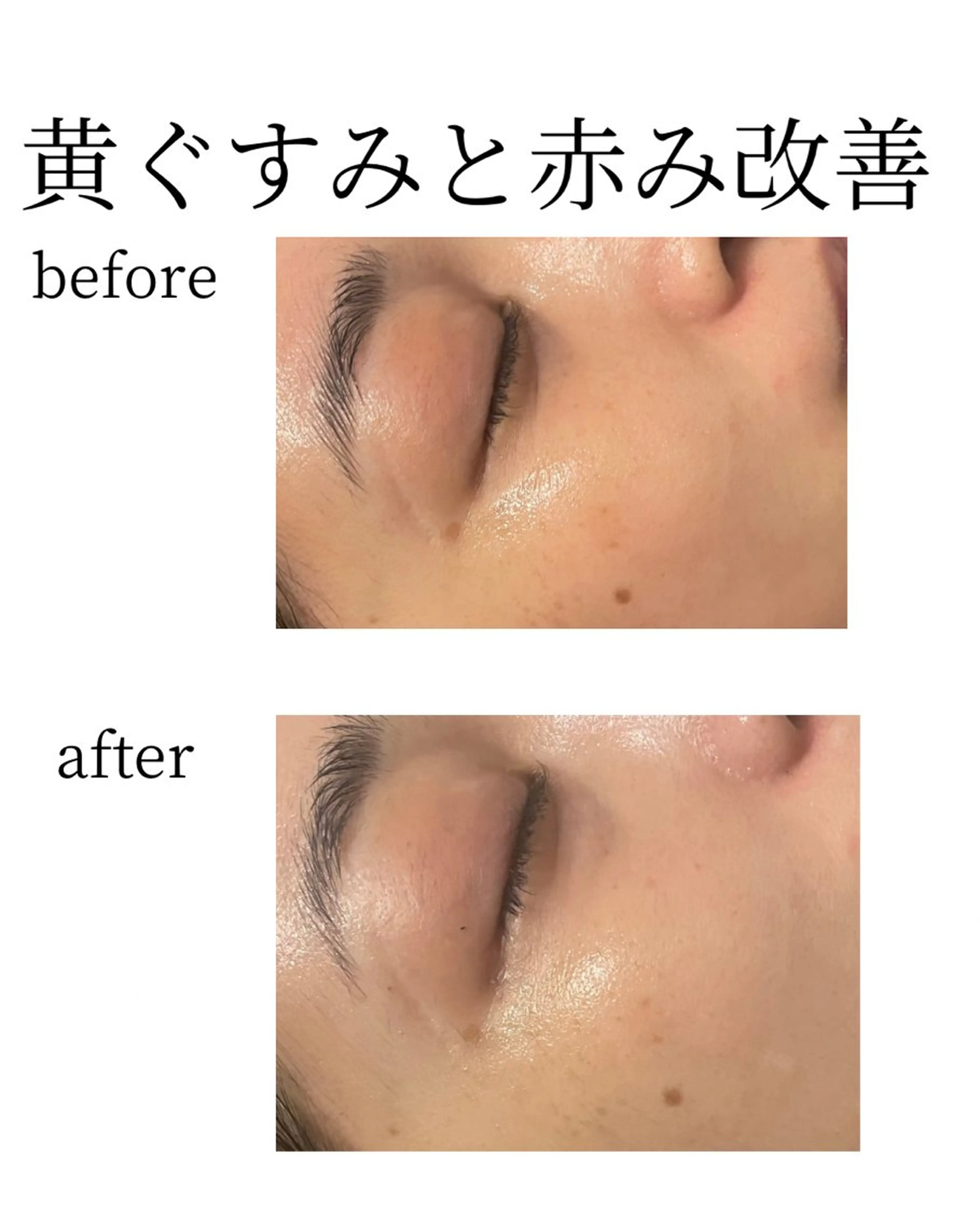 Salon【yuzu.】所属・🍊肌管理×美眉 【yuzu.】の眉毛・アイブロウイメージ