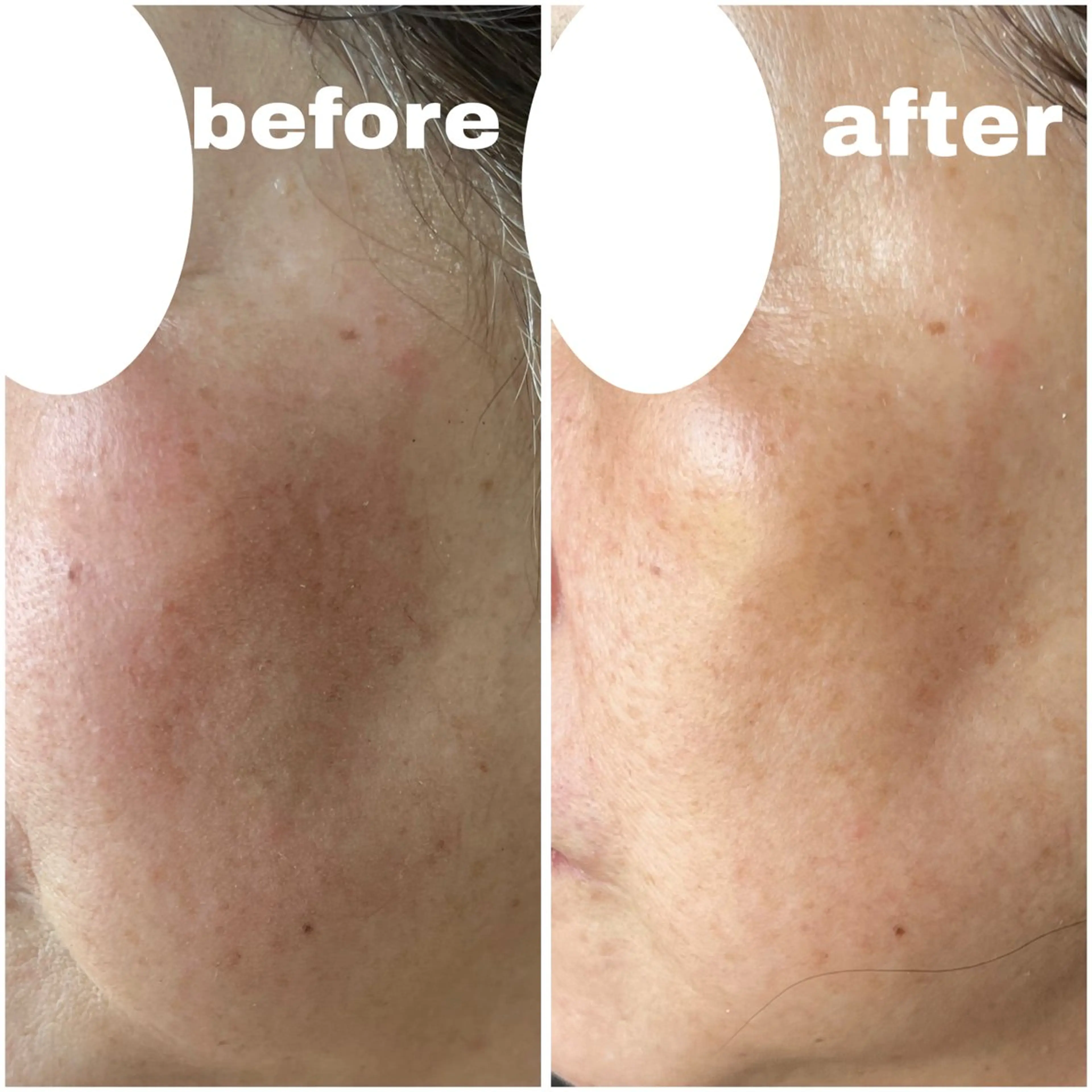 エステ Salon.Rire サロン リルのエステ・リラクイメージ