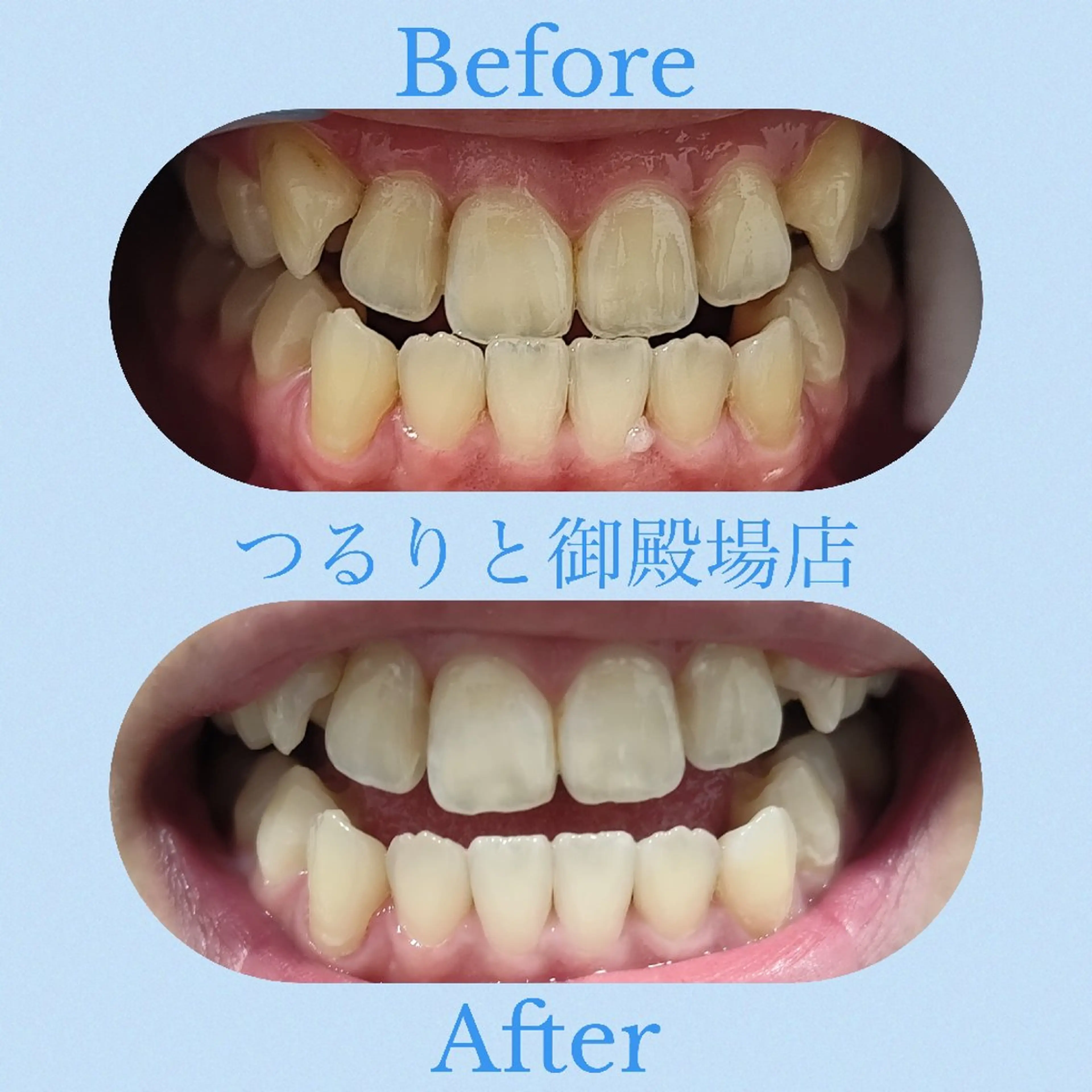 美肌脱毛サロン つるりと御殿場店所属・美肌脱毛サロン つるりとのその他イメージ