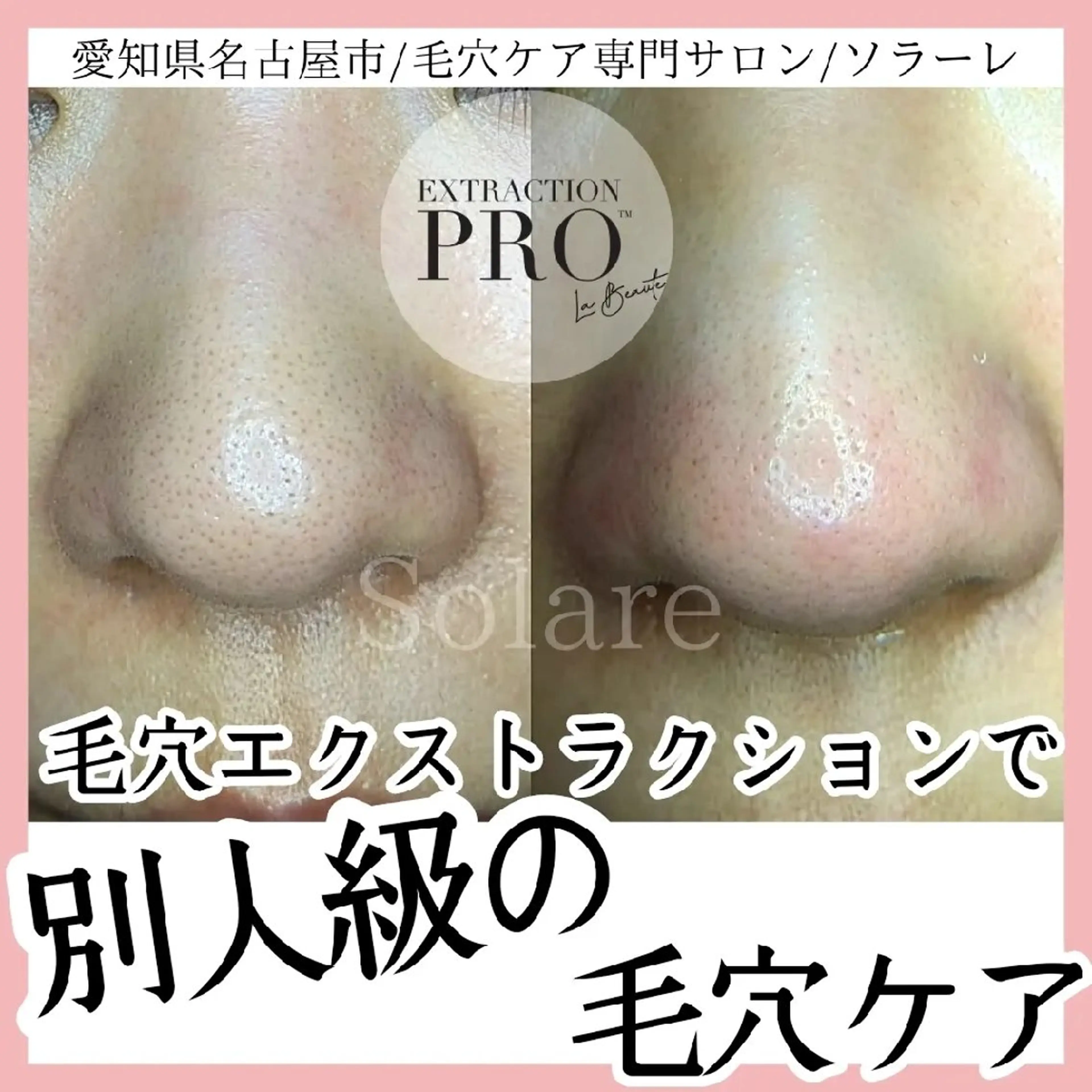  毛穴洗浄・まつ毛 の専門店 ソラーレのエステ・リラクイメージ