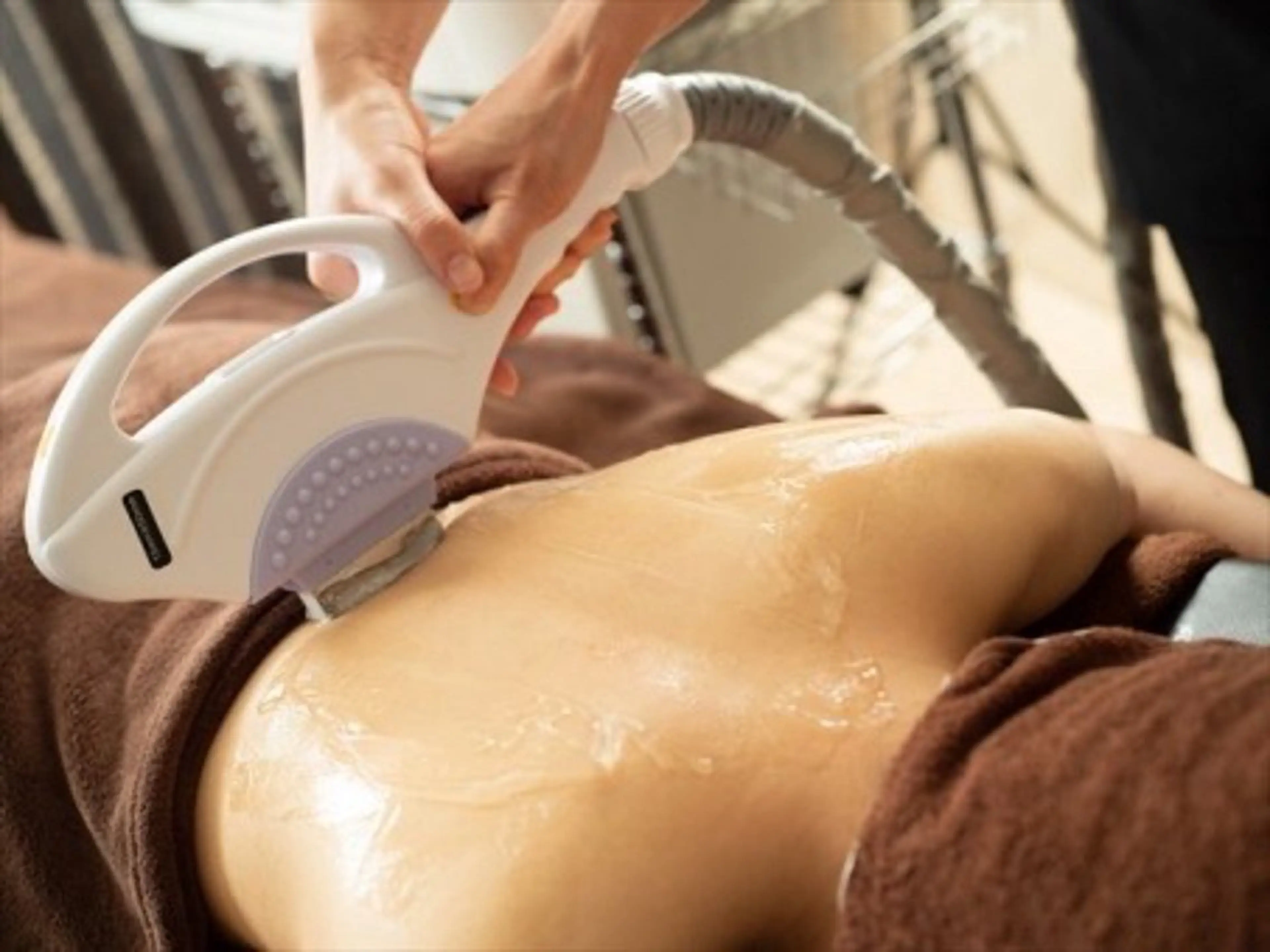 全身脱毛(VIO込み)の写真