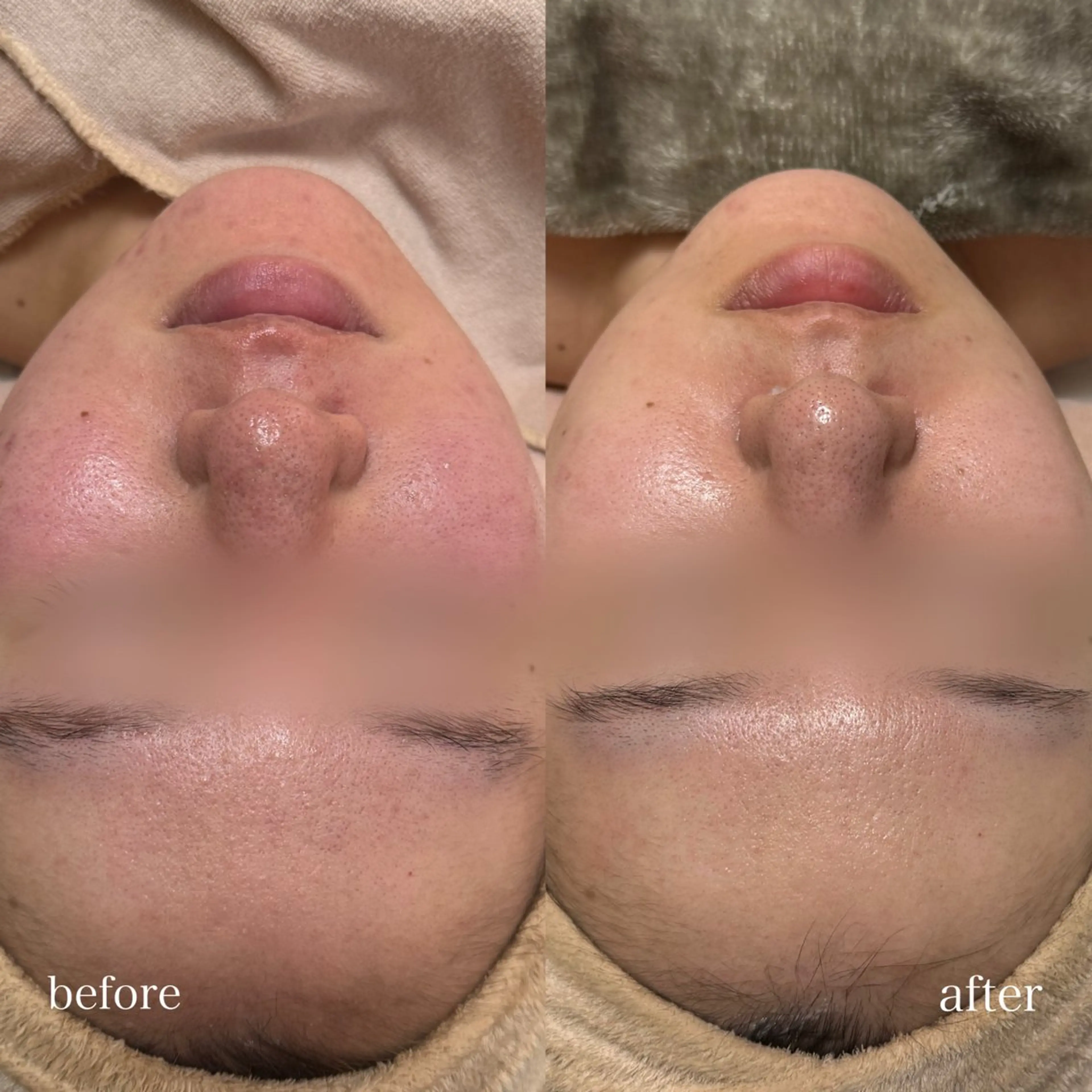 Lys Blanc OTOKAのエステ・リラクイメージ