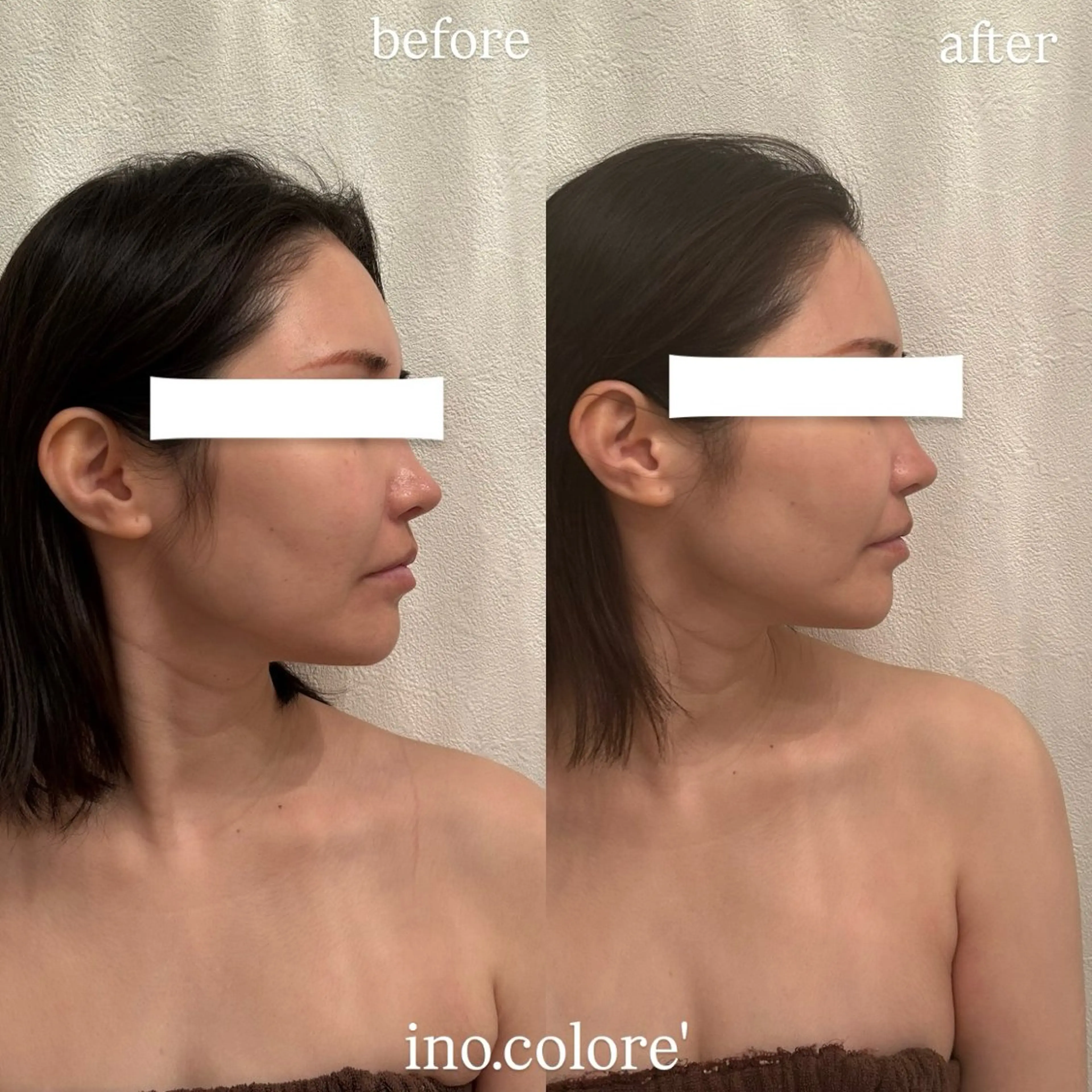 エステサロンino.colore'所属・小顔サロン ino.coloreのエステ・リラクイメージ