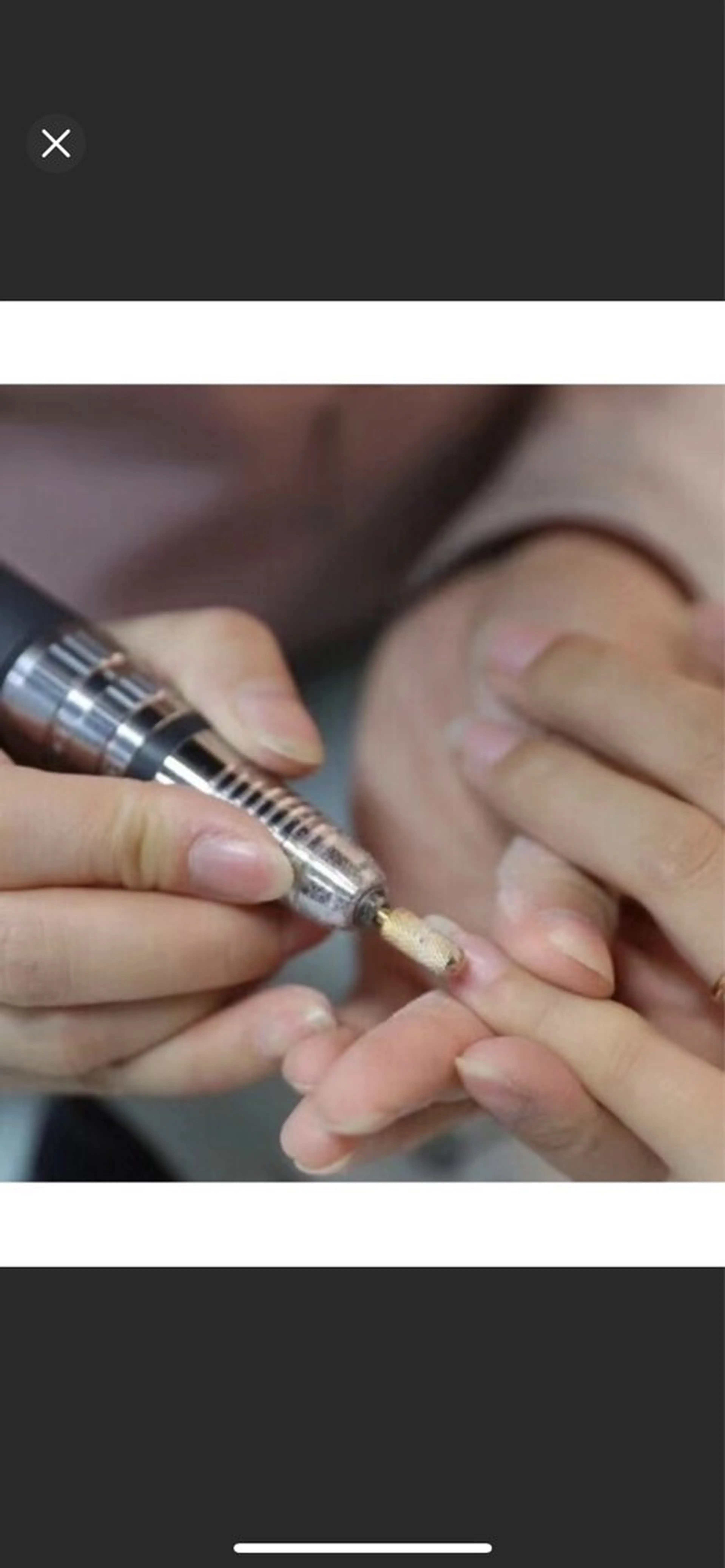 自爪オフのみの写真