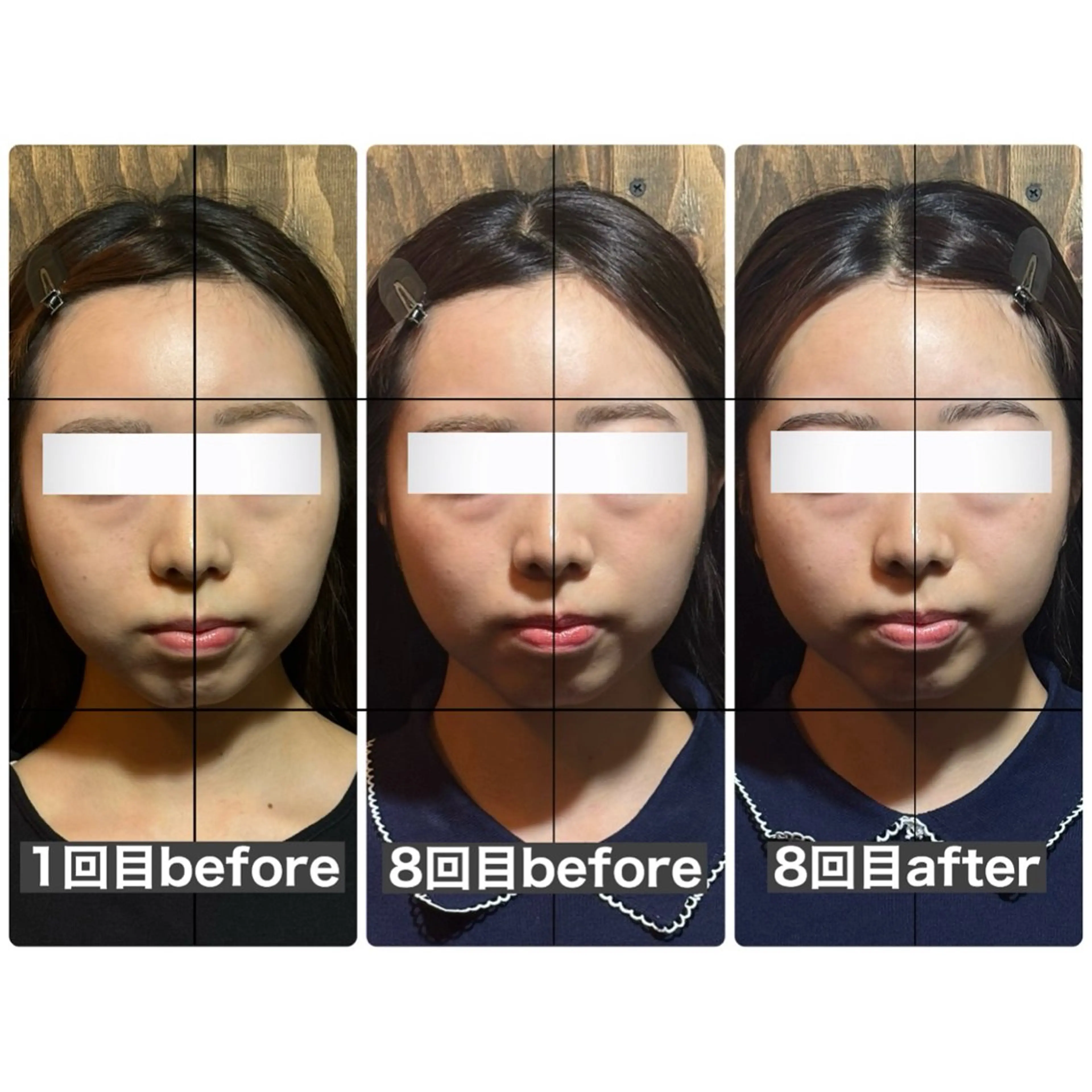 エステ リラク 💎後悔させない小顔 矯正💎イトヤマ🌱のエステ・リラクイメージ