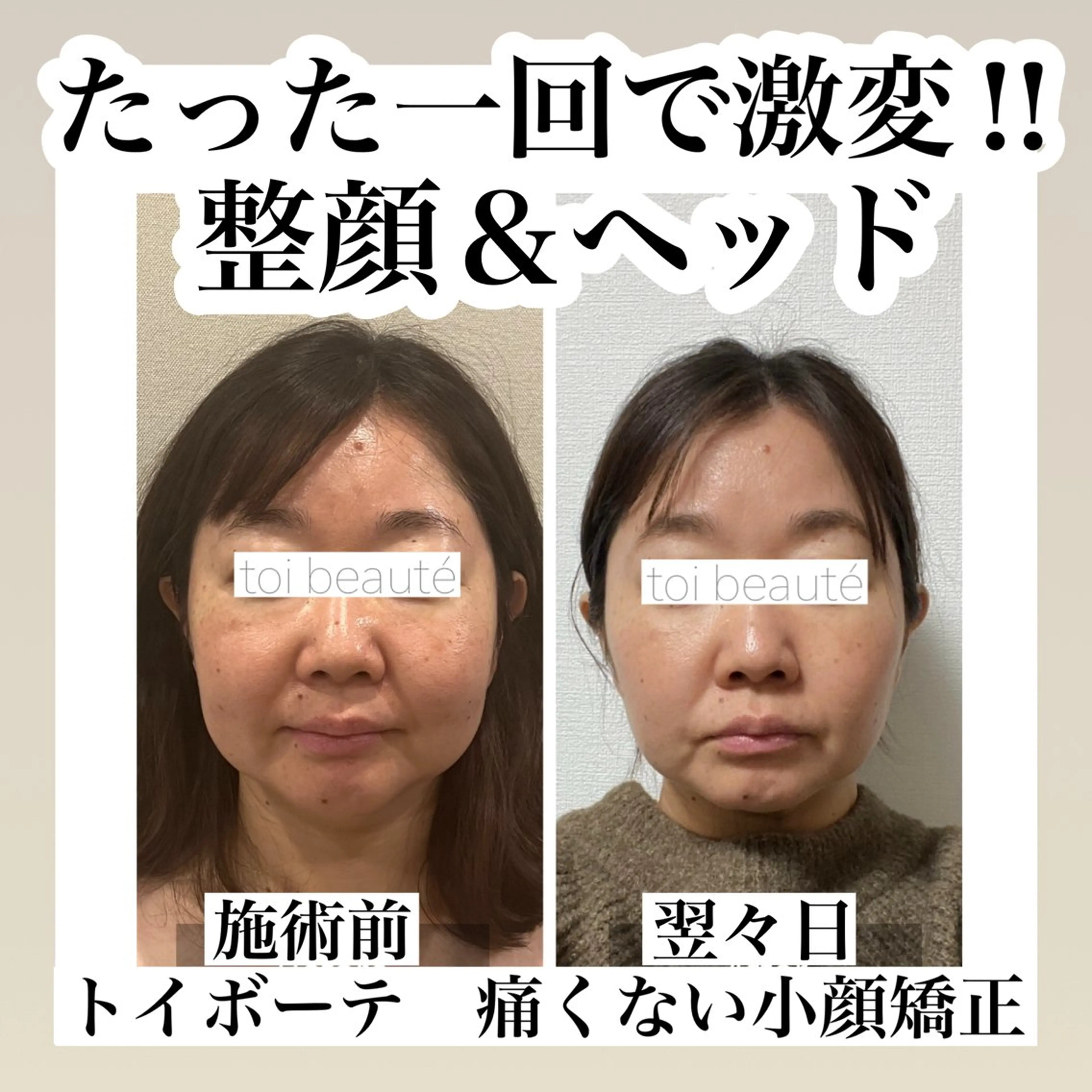 柳瀬 絵美のマツエク・マツパデザイン