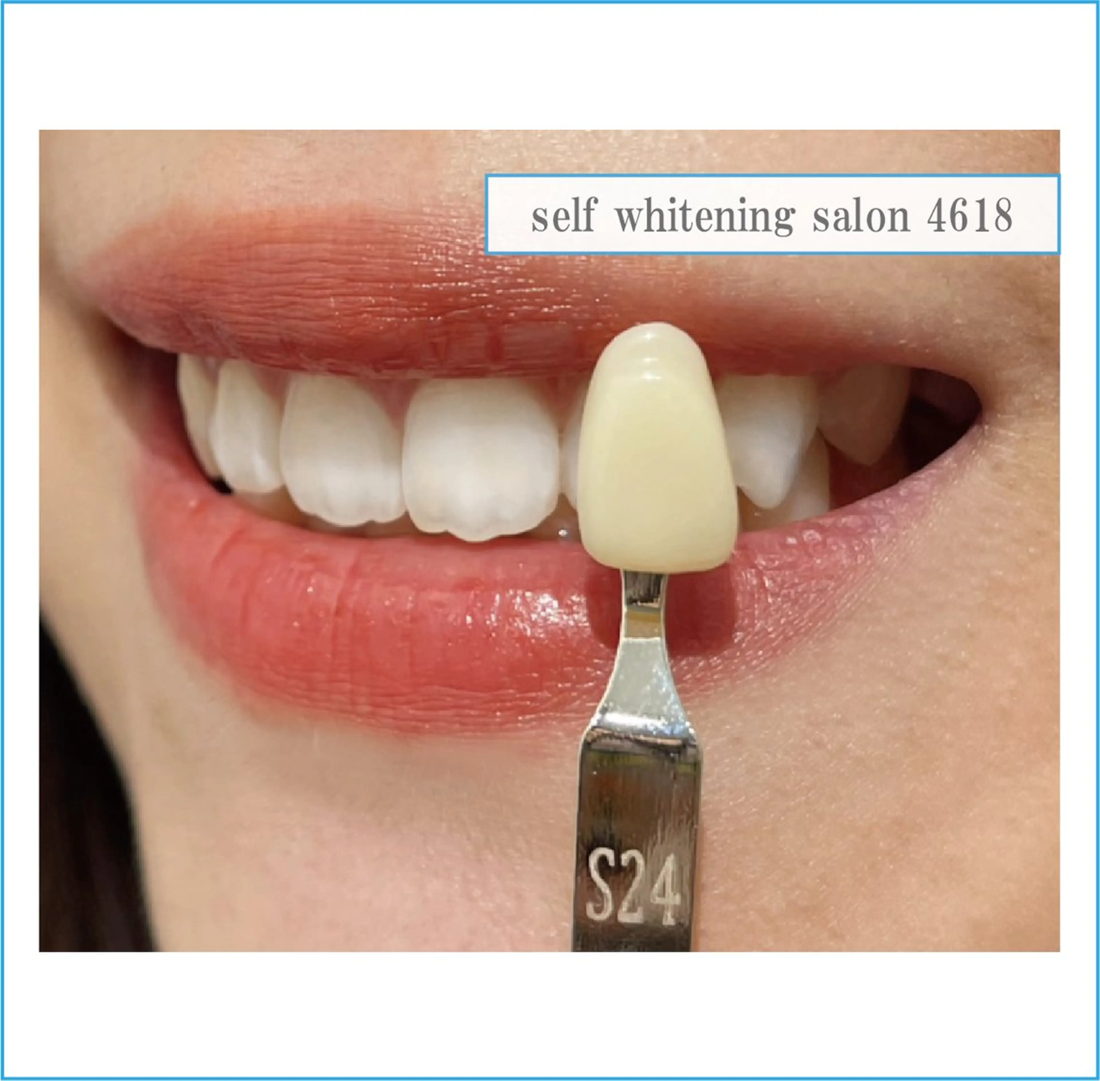 self whitening salon 4618所属・ホワイトニングサロン 4618のその他イメージ