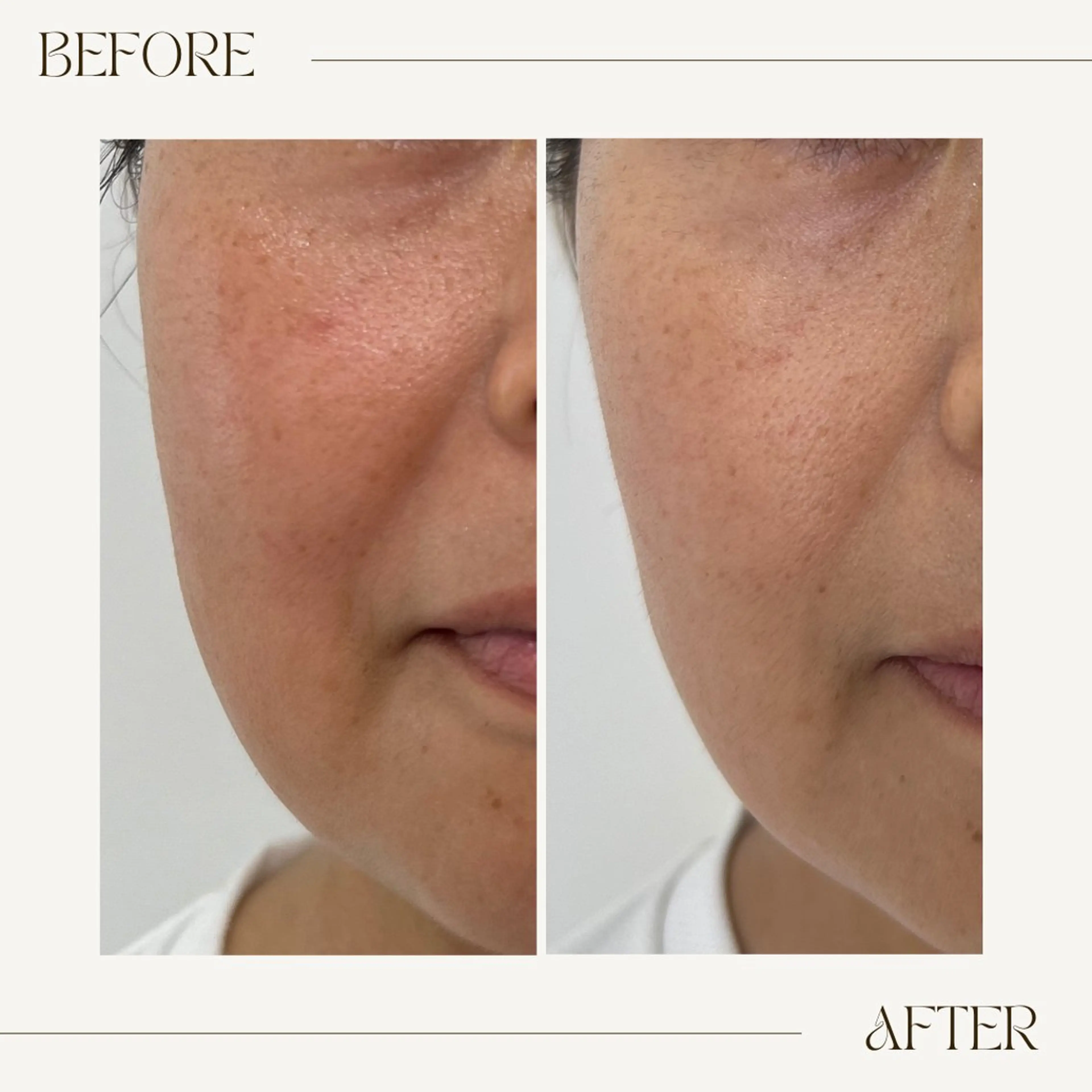 GranDir所属・GranDir 堀井美沙のエステ・リラクイメージ