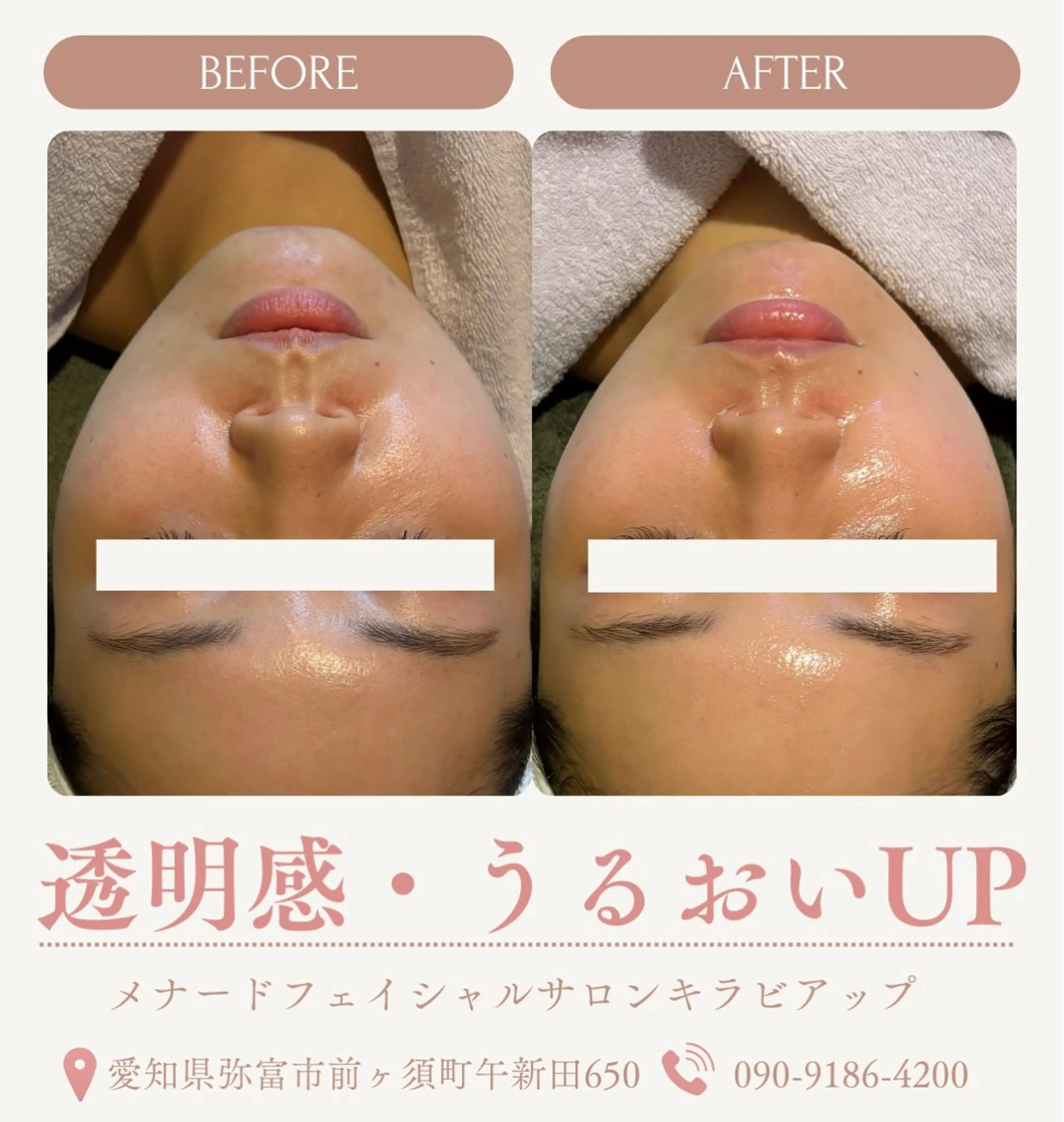 フェイシャルエステ50分の写真