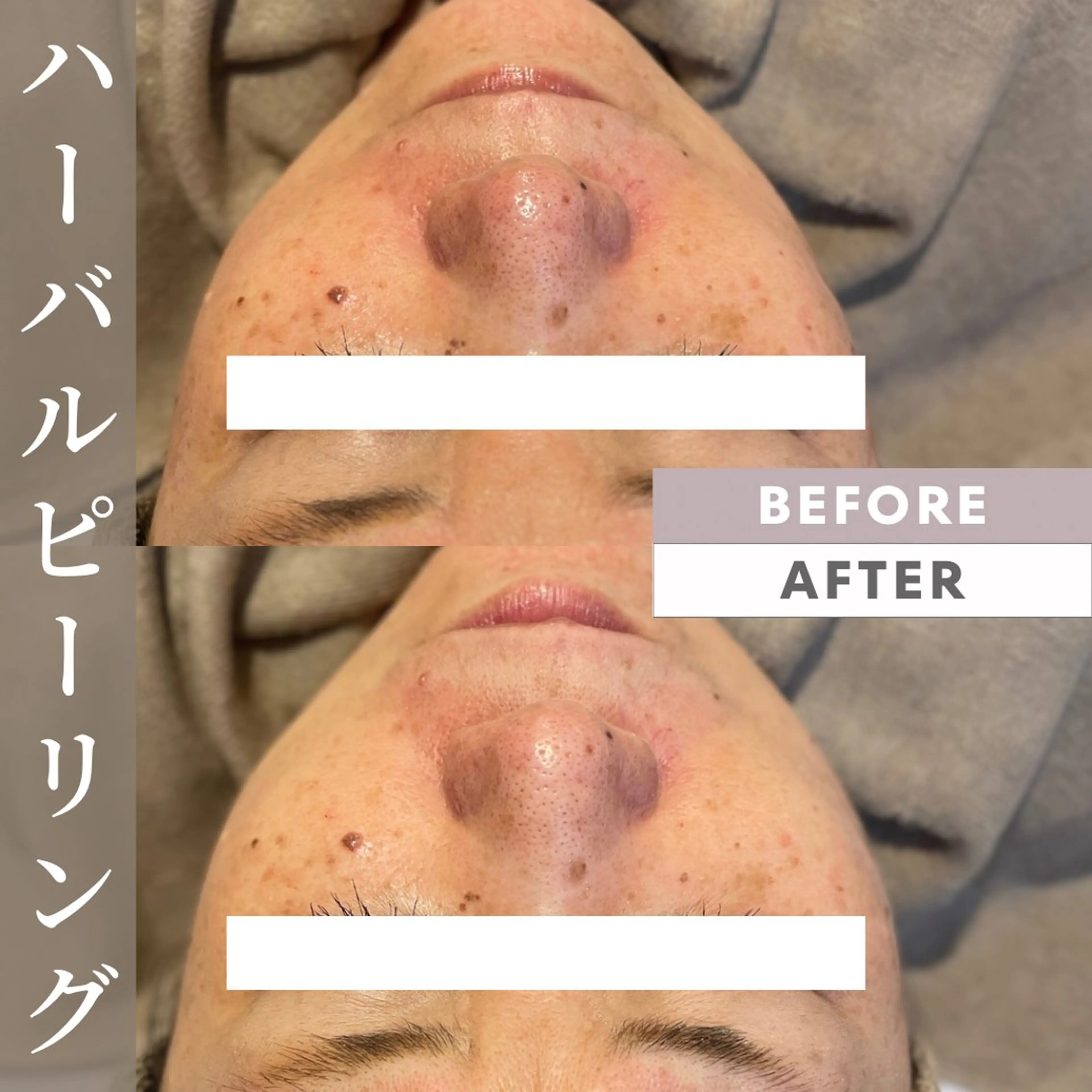 エステ Lassy Yuriの眉毛・アイブロウイメージ