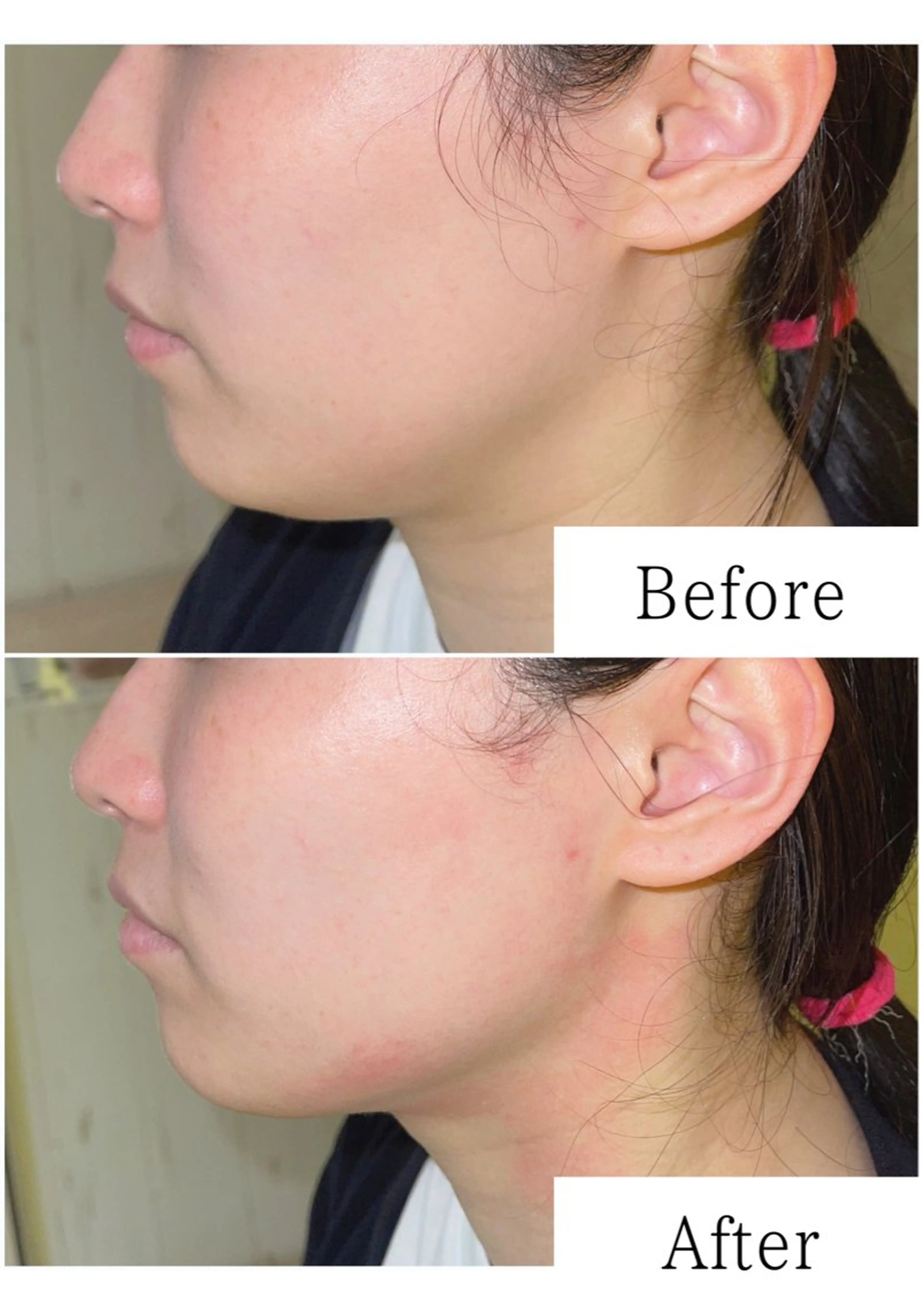 その他 SELF  BEAUTY gracia浦添店所属・gracia 浦添店のその他イメージ