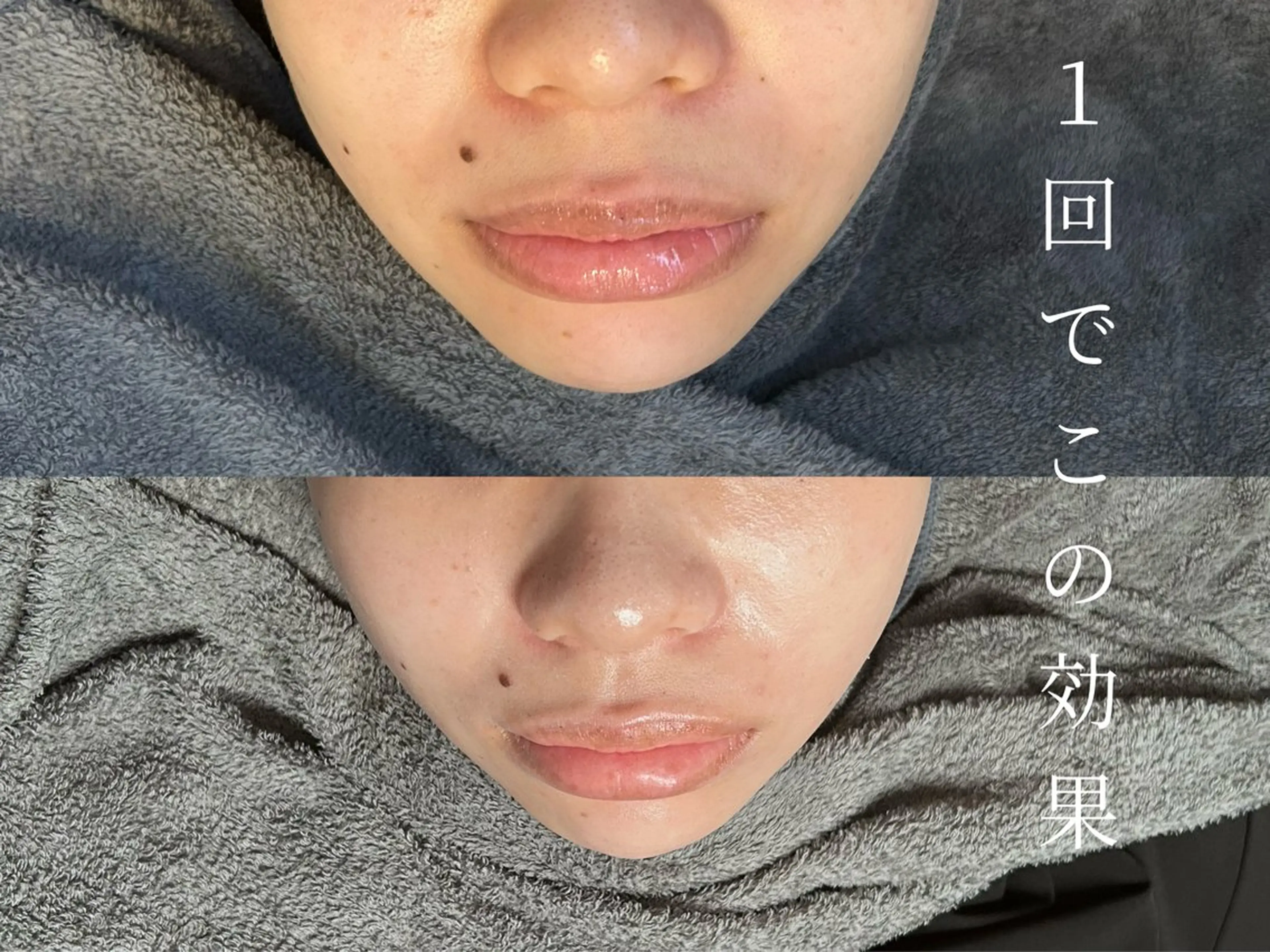 12月までの限定価格🙇♀️ハーブピーリング🌿オプション3つプレゼント🎁の写真