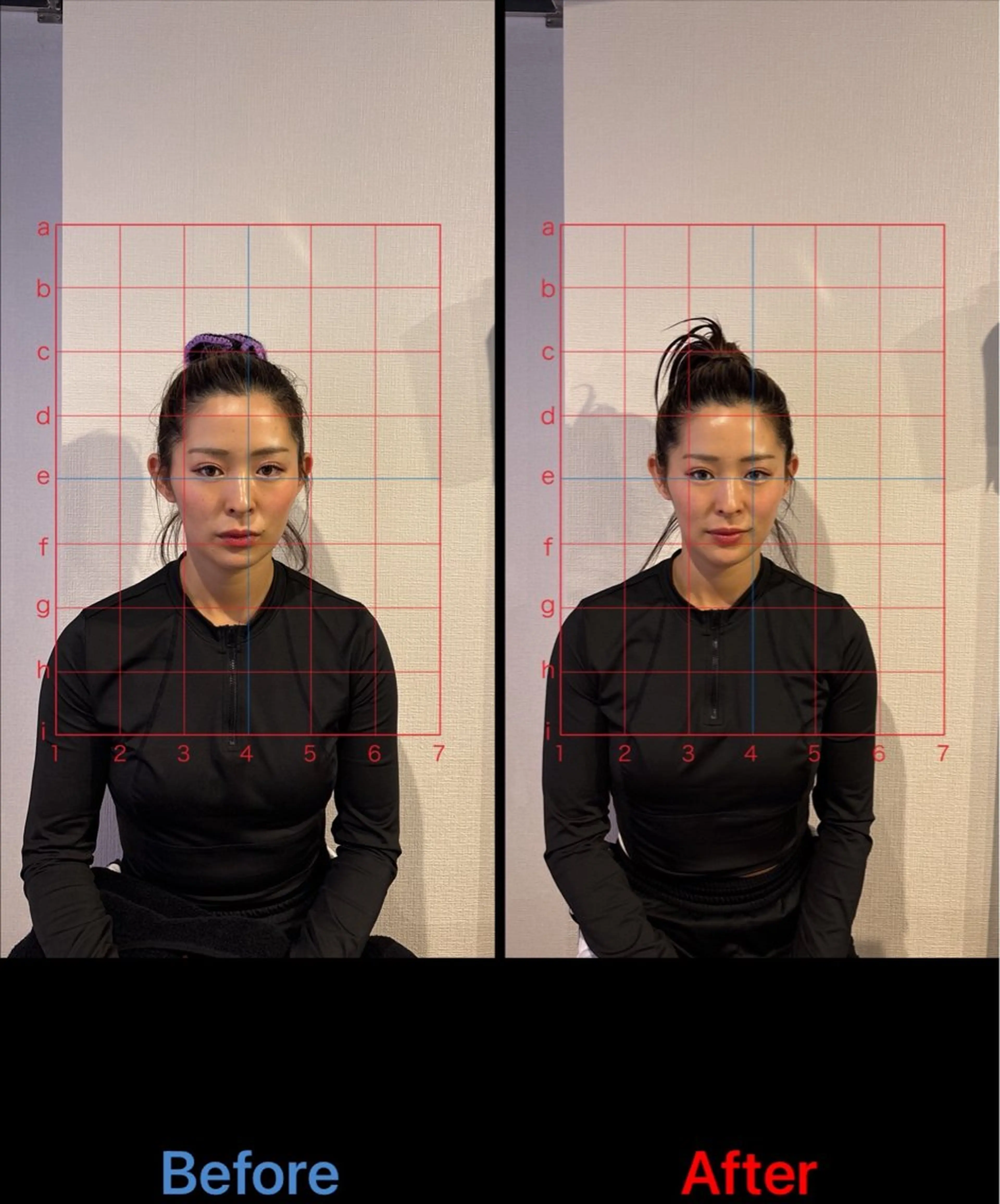 【枚方】小顔美容鍼+小顔整体60分　　　　　　　　　　　　　大阪府/枚方市駅/徒歩5分の写真