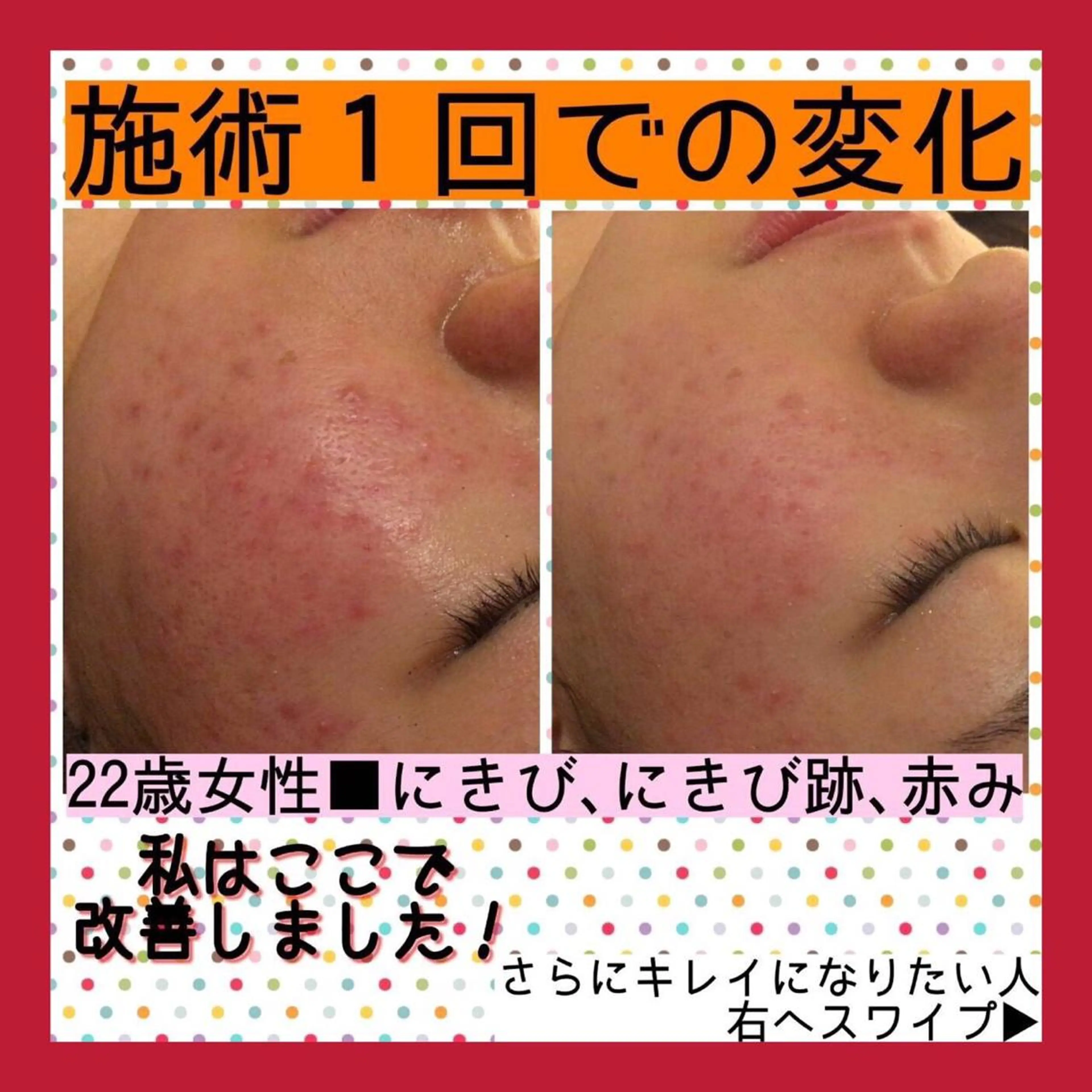 ミディアム カラー パーマ ヘアアレンジ メンズ キッズ ネイル マツエク・マツパ ニキビ・肌質改善専門 ♡人生が変わるサロンのエステ・リラクイメージ