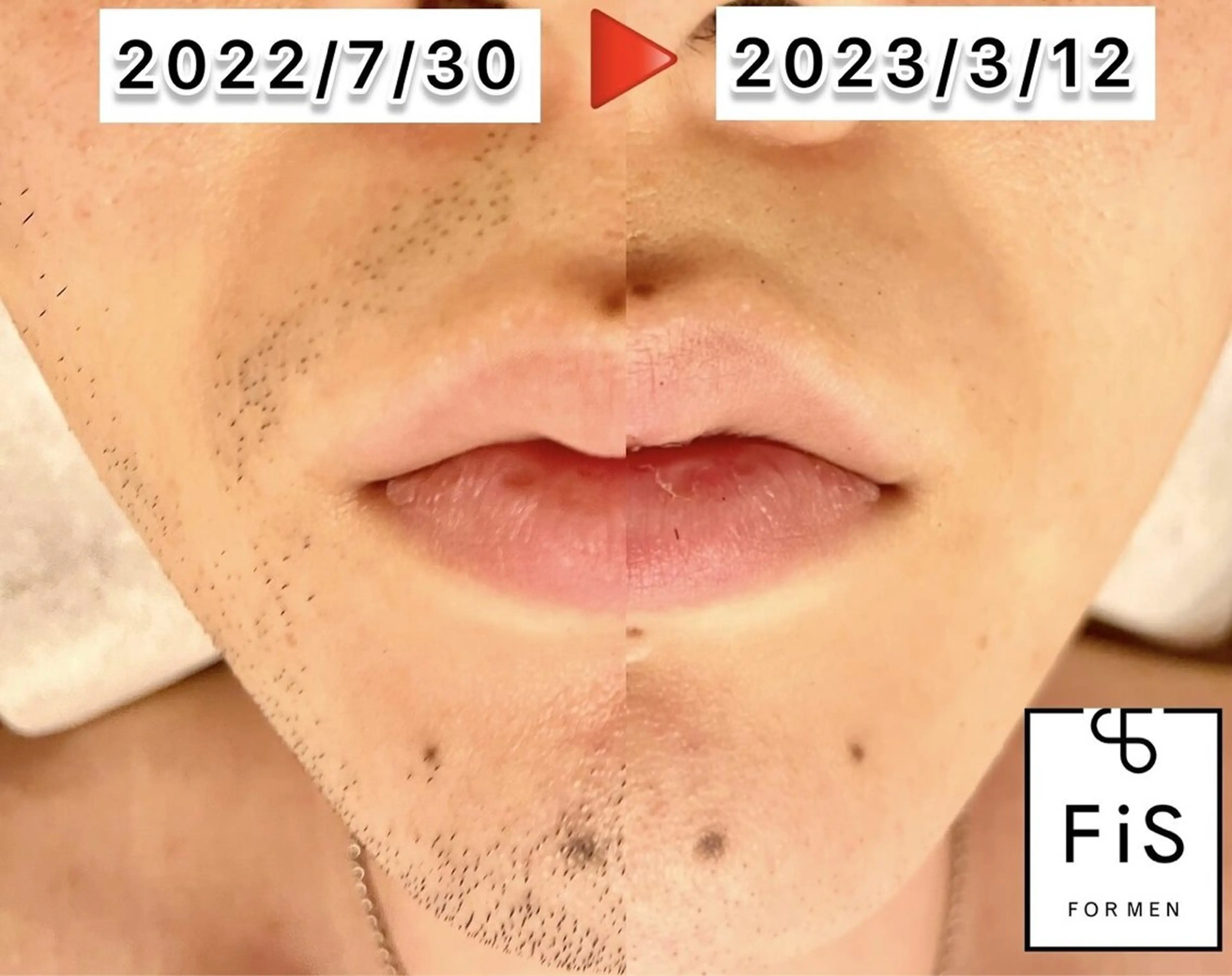 脱毛サロン&リンパマッサージ　FIS　大井町店所属・脱毛サロンFIS 大井町店のエステ・リラクイメージ