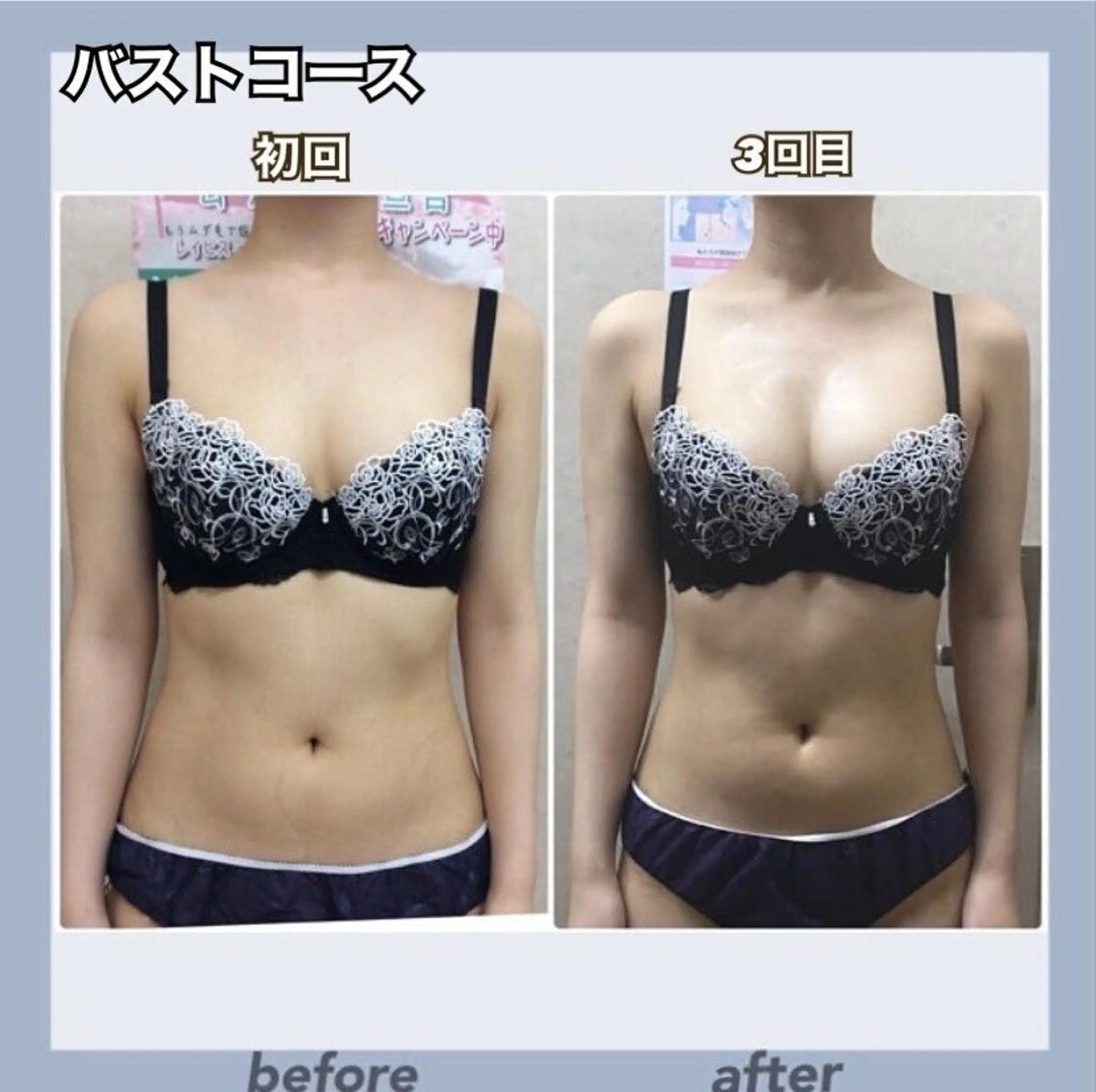 🎀マシュマロ美乳バスト🎀マッサージ＆光照射＆EMSで劇的バストケア💖筋膜リリース肩甲骨ストレッチで背中美人✨の写真