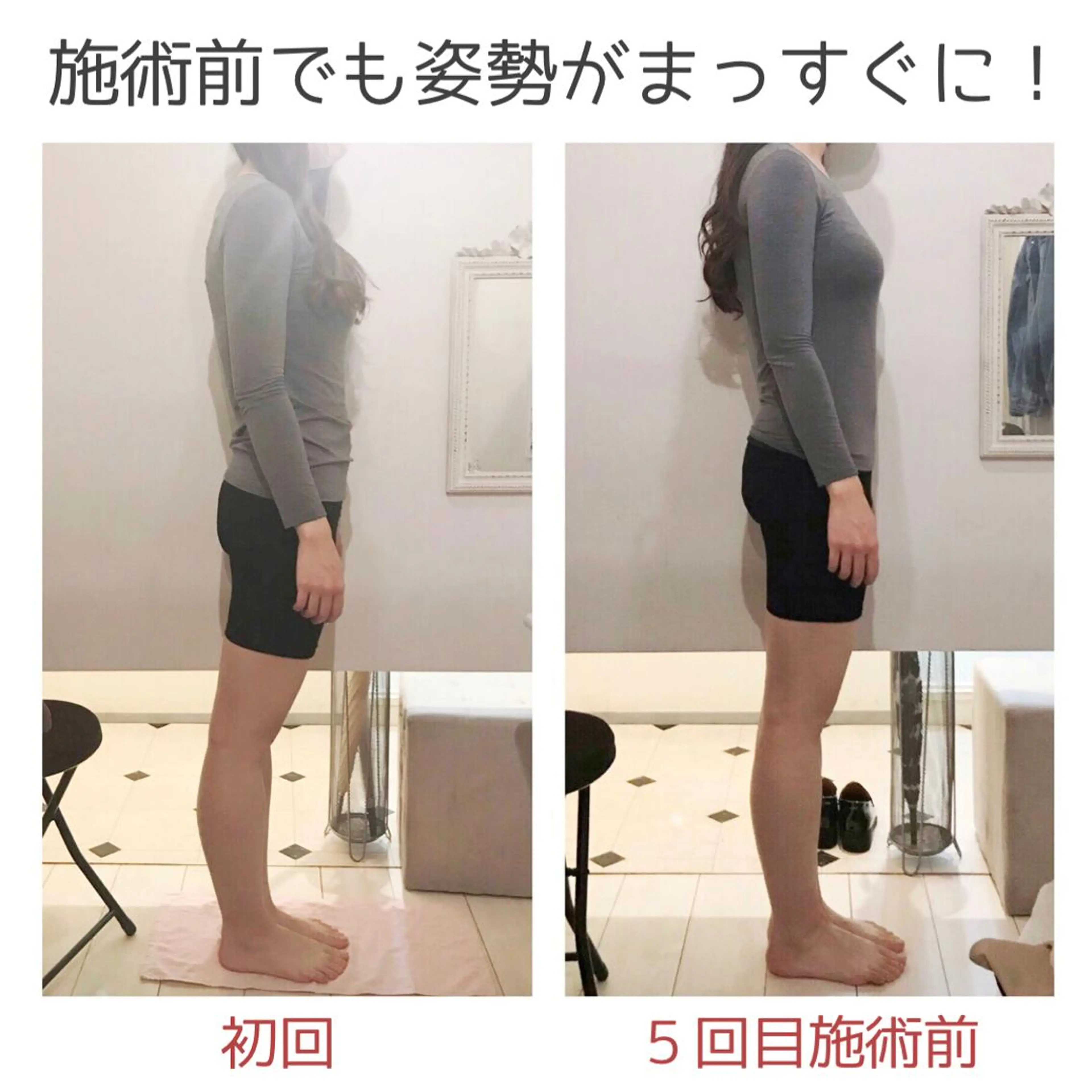 小顔モニター 募集のエステ・リラクイメージ