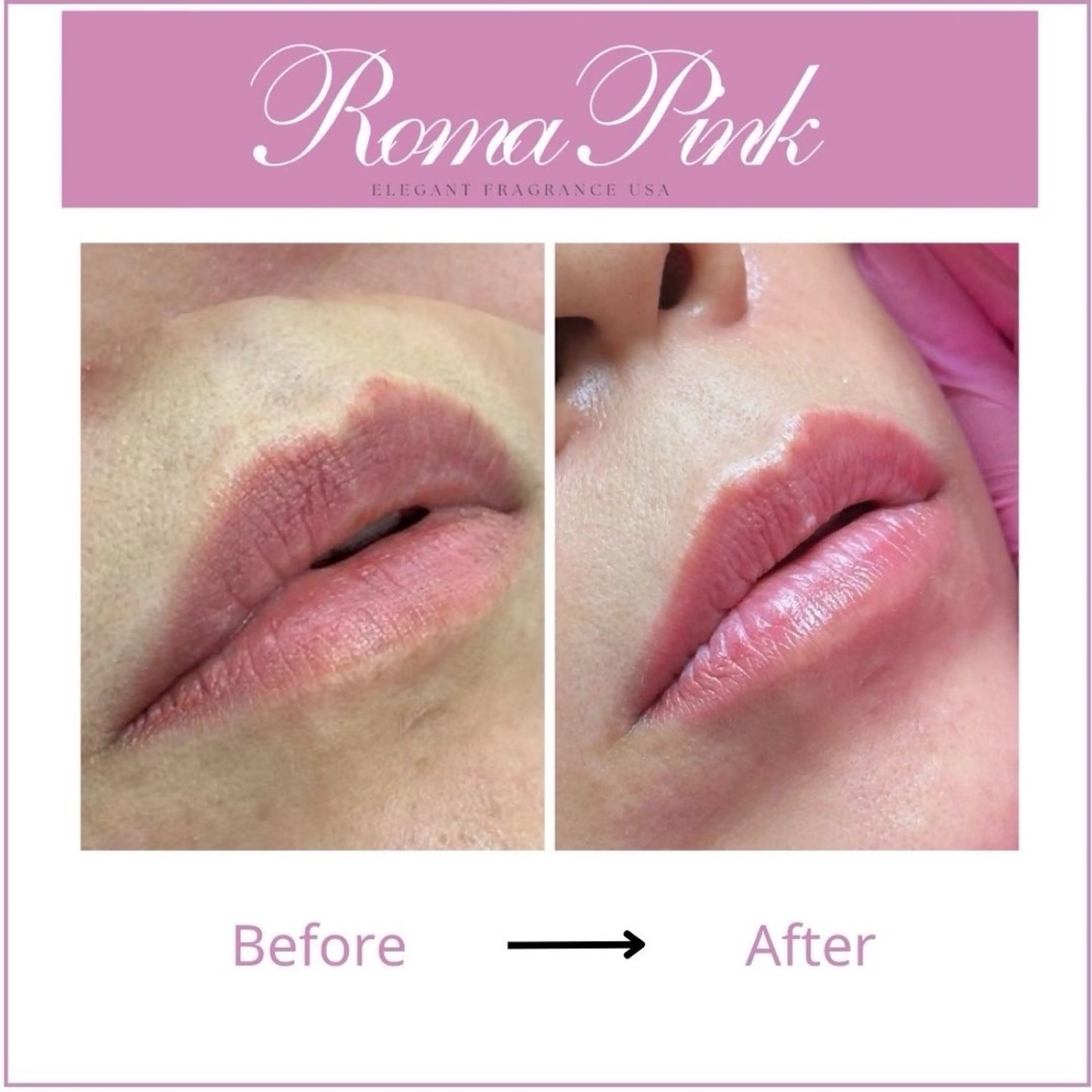 【韓国最先端ローマピンク】RomaPinkリップ◆ カウンセリングの写真