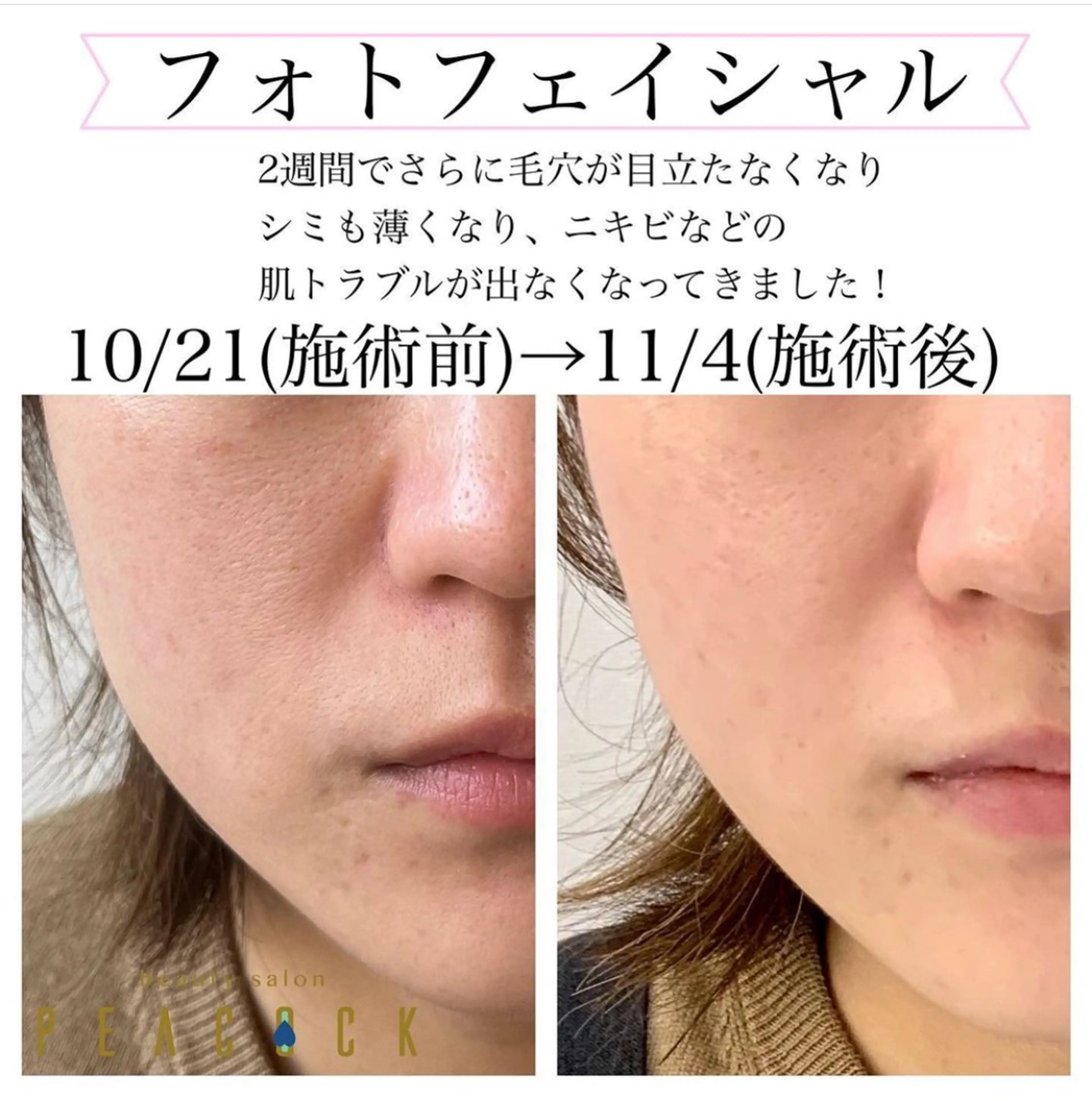 salon peacockのマツエク・マツパデザイン