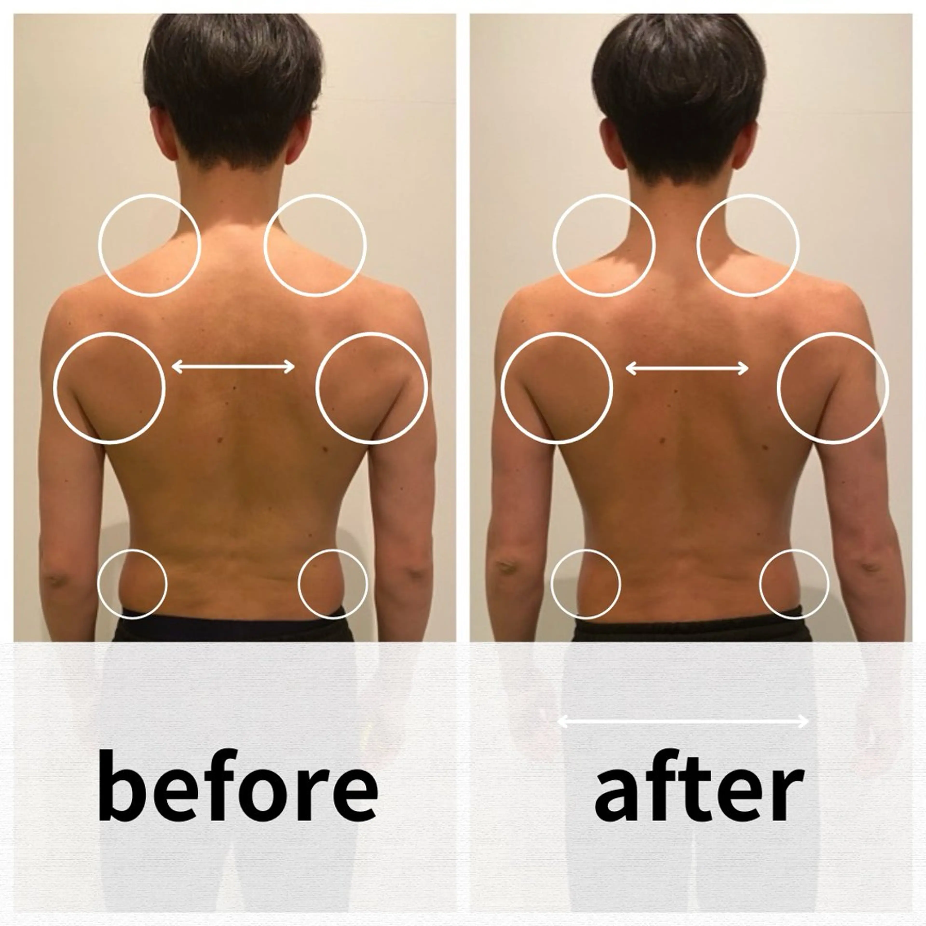 美容鍼/ヘッドスパ/ 💎さかもとのエステ・リラクイメージ