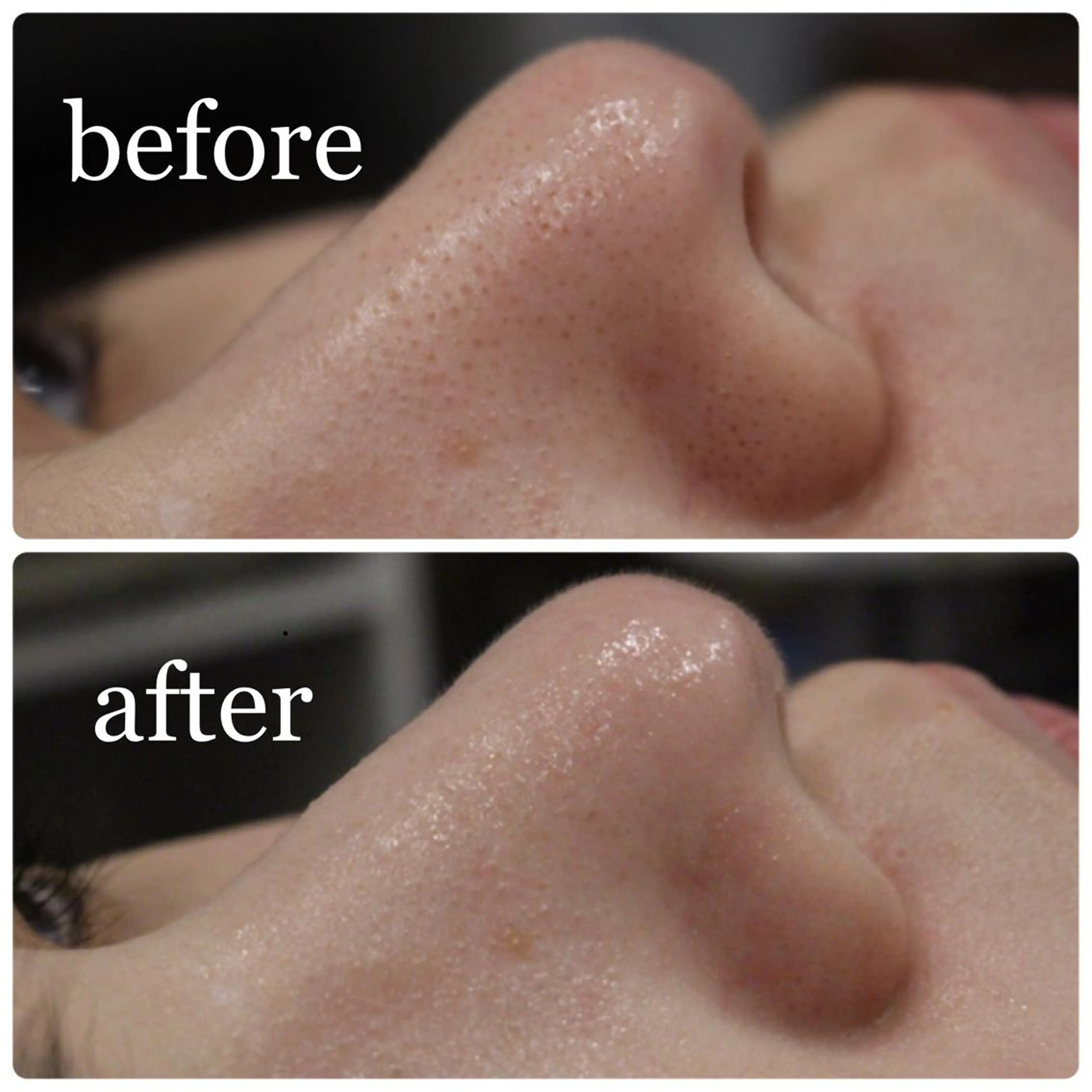 エステ ANRIRE (アンリール)のエステ・リラクイメージ