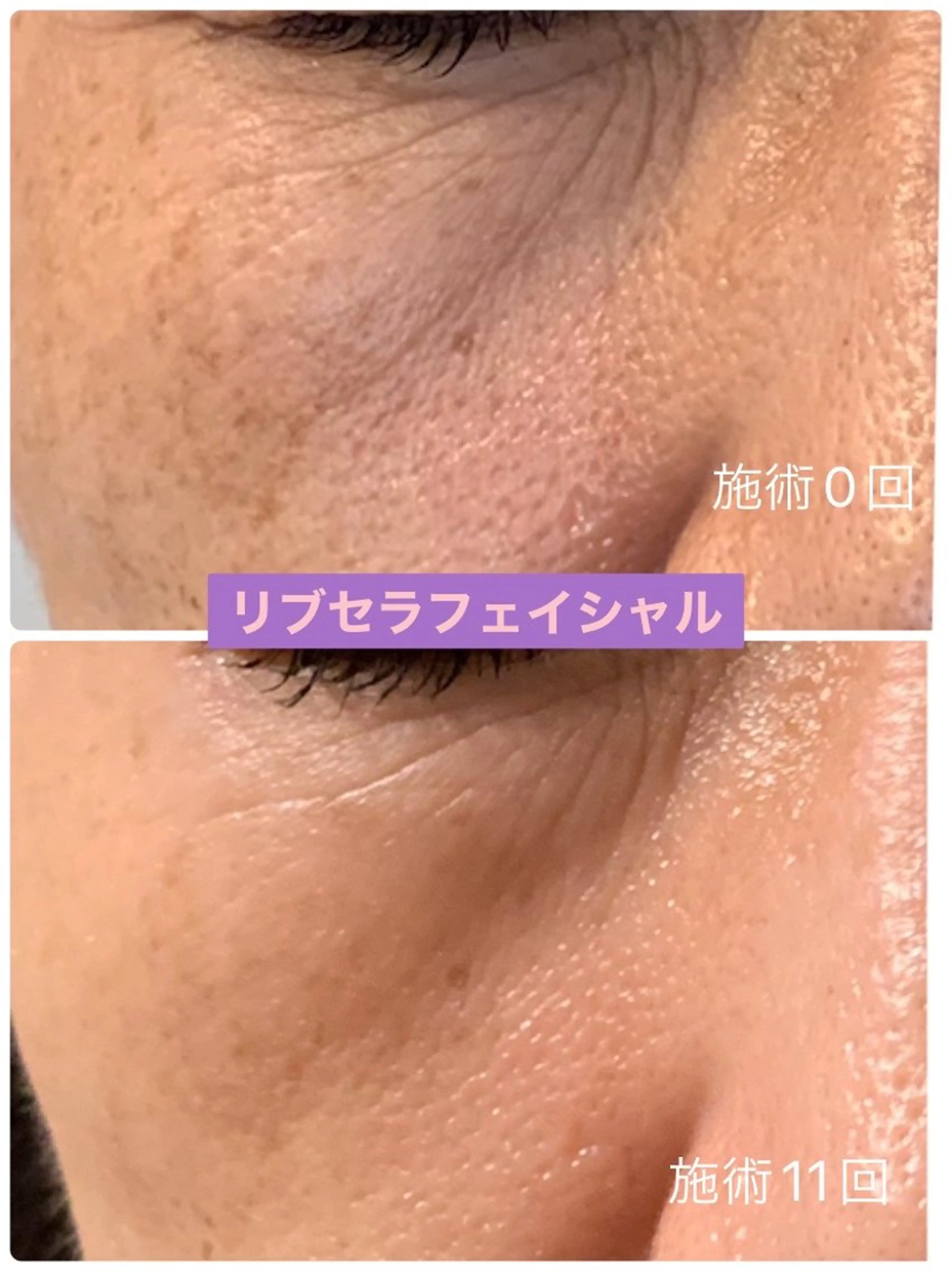 エステ Private Salon Prunelle所属・プライベートサロン プリュネルのエステ・リラクイメージ