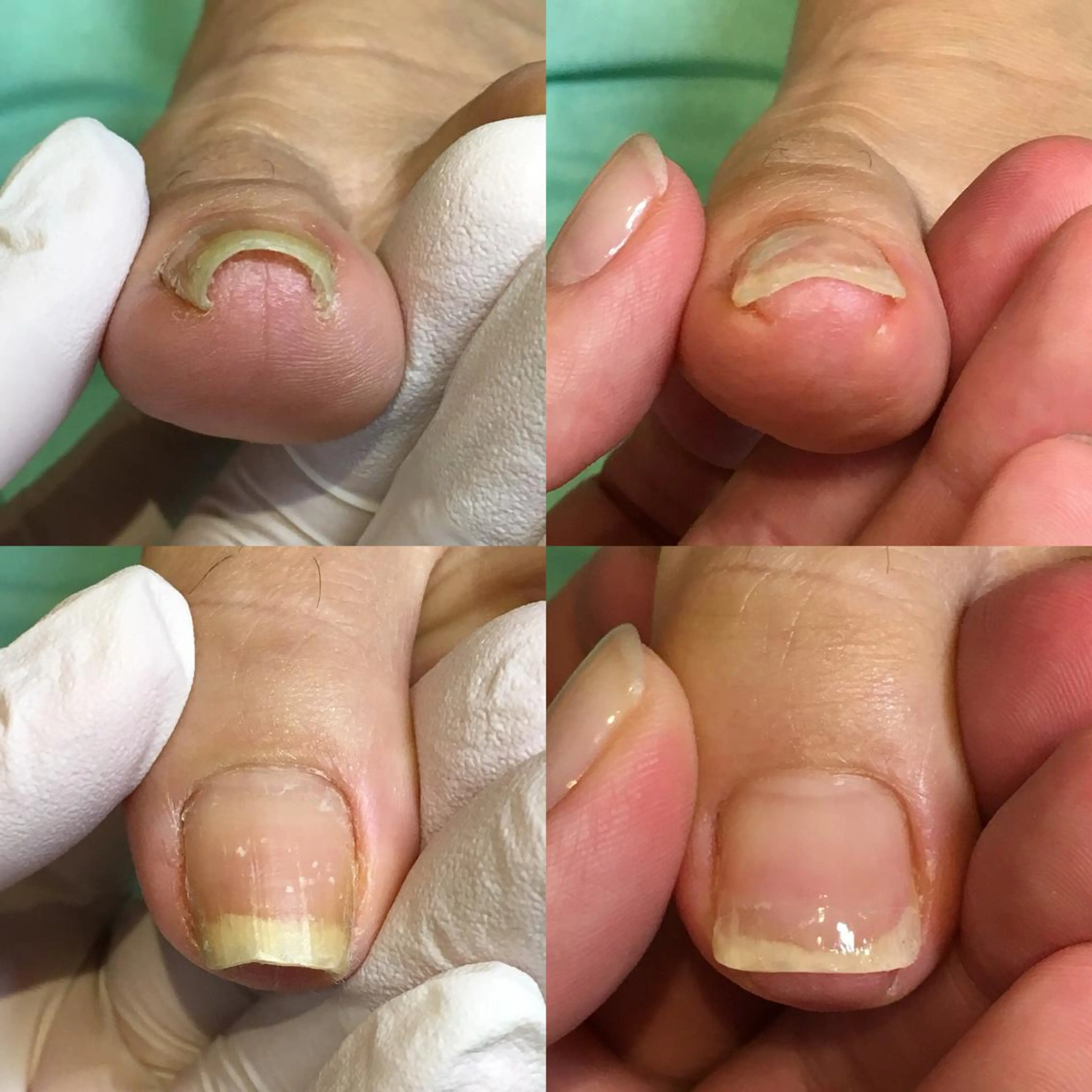 ネイル 東京巻き爪アカデミー所属・東京巻き爪 アカデミーのエステ・リラクイメージ