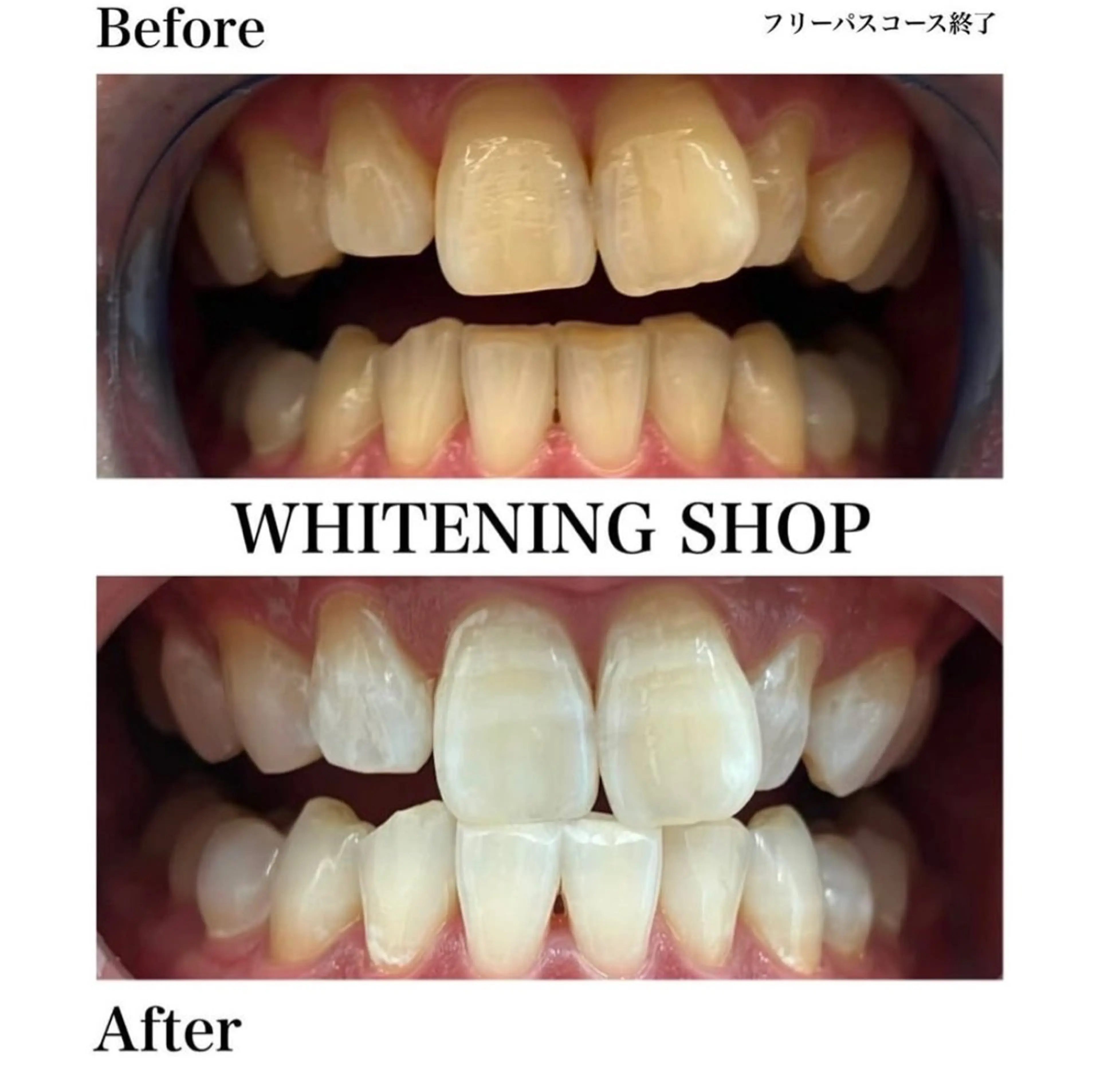 ホワイトニングショップ伊丹店所属・ホワイトニング ショップ伊丹店のその他イメージ