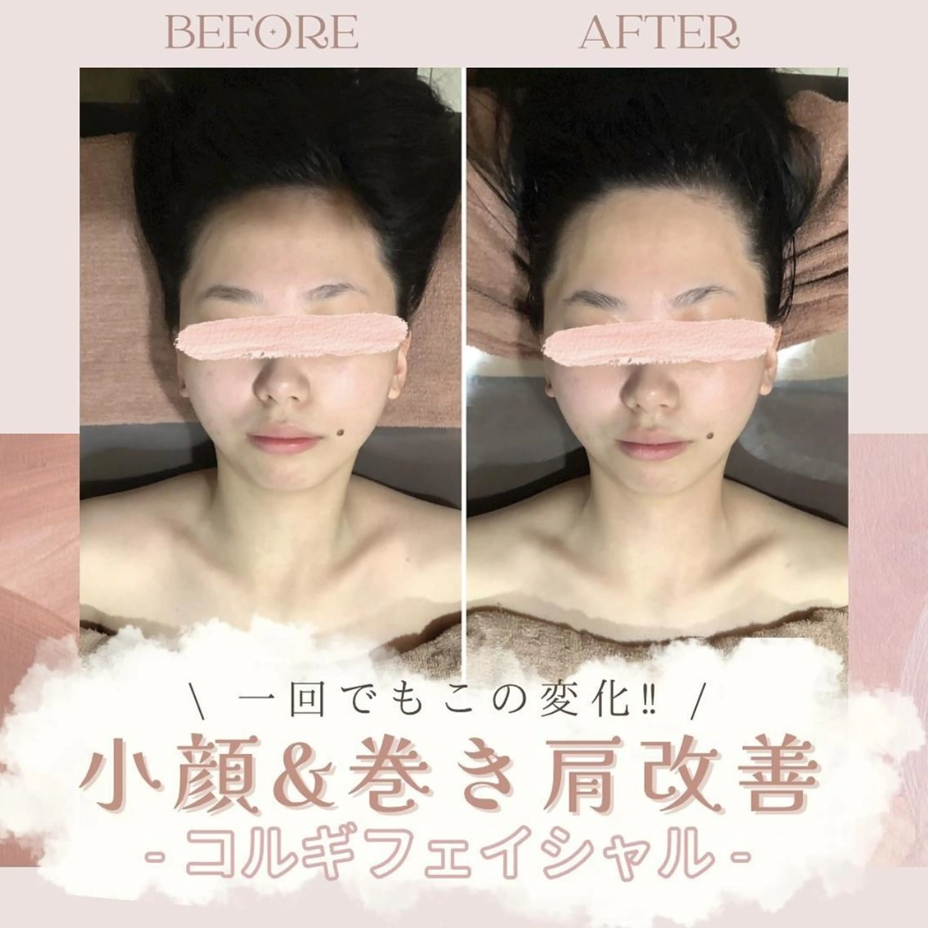 🌿小顔・痩身・脱毛 レイビス川崎店🌿のエステ・リラクイメージ