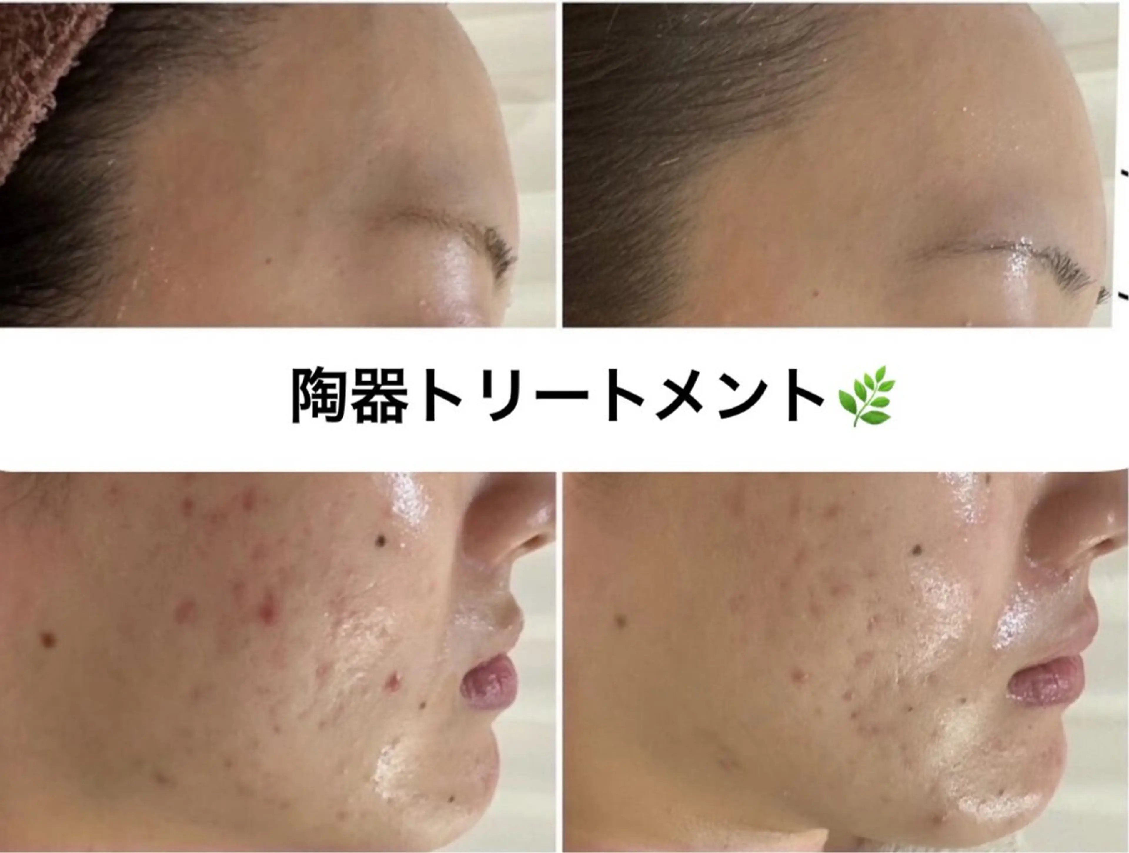 エステ WHITE AQUA 🌼柏店のエステ・リラクイメージ