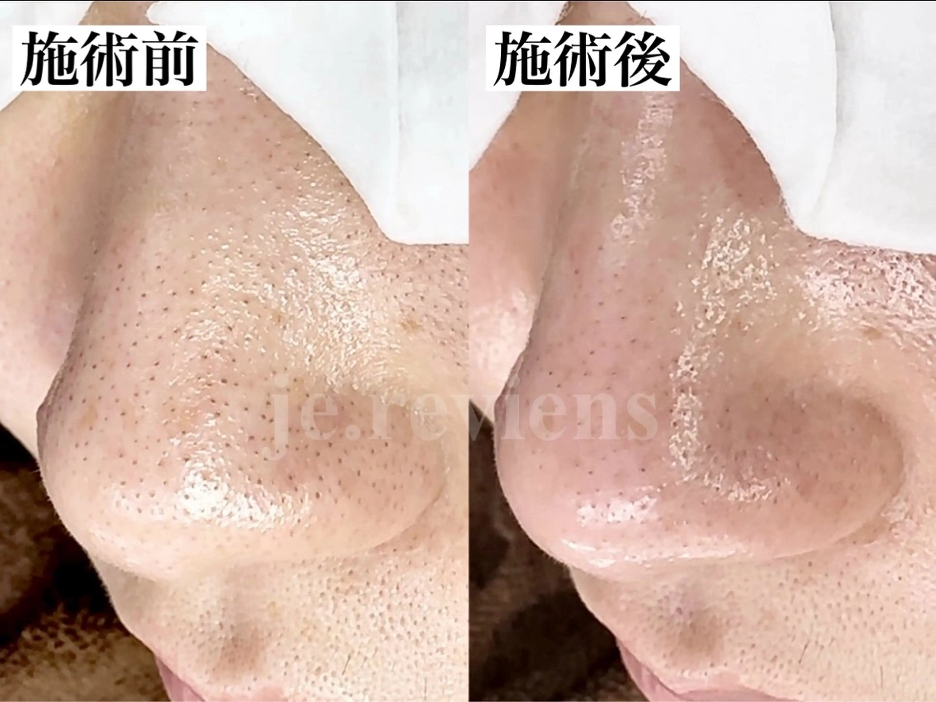 ジュルビアン美容室所属・ジュルビアン 美容室のエステ・リラクイメージ