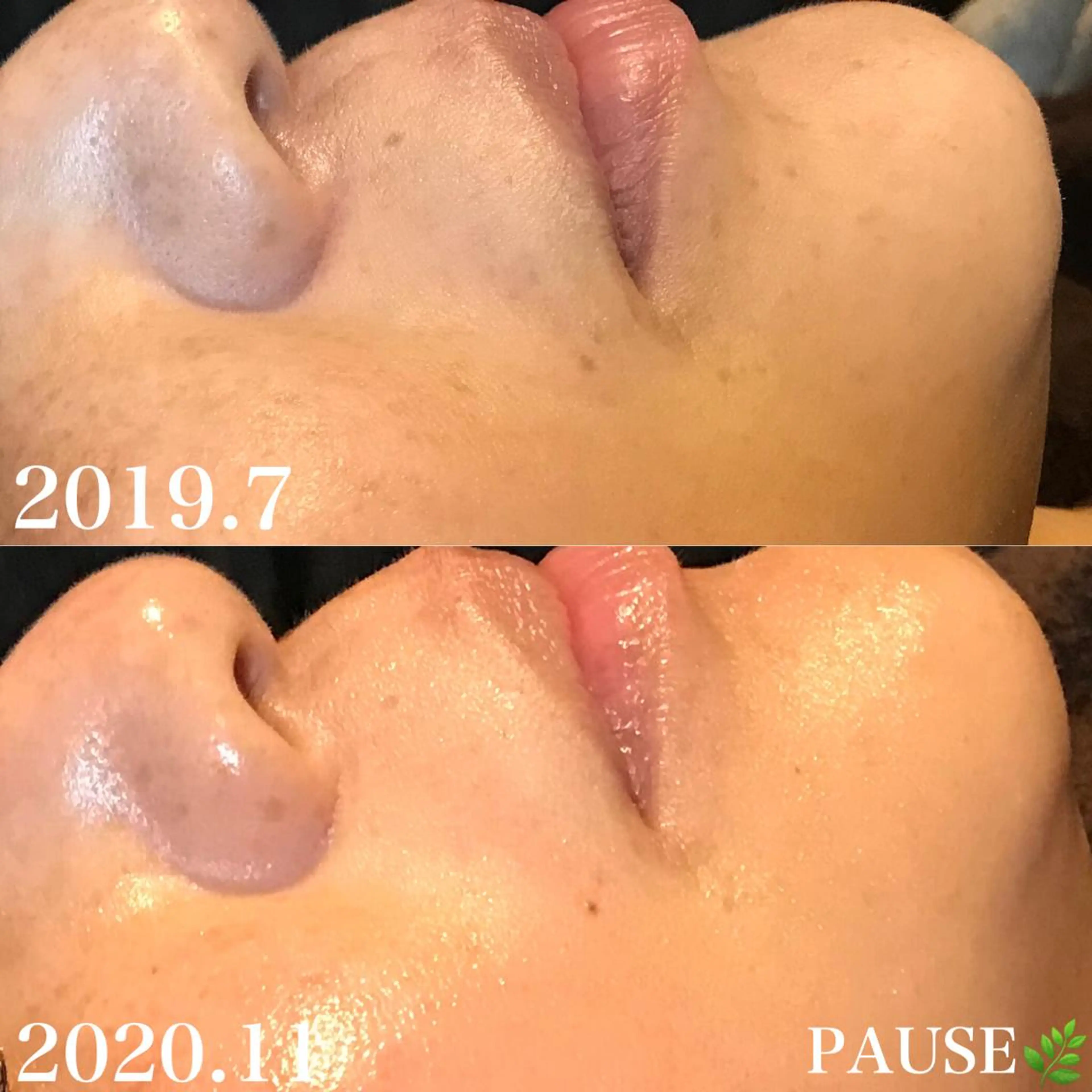 エステ 浜野 恵美のエステ・リラクイメージ