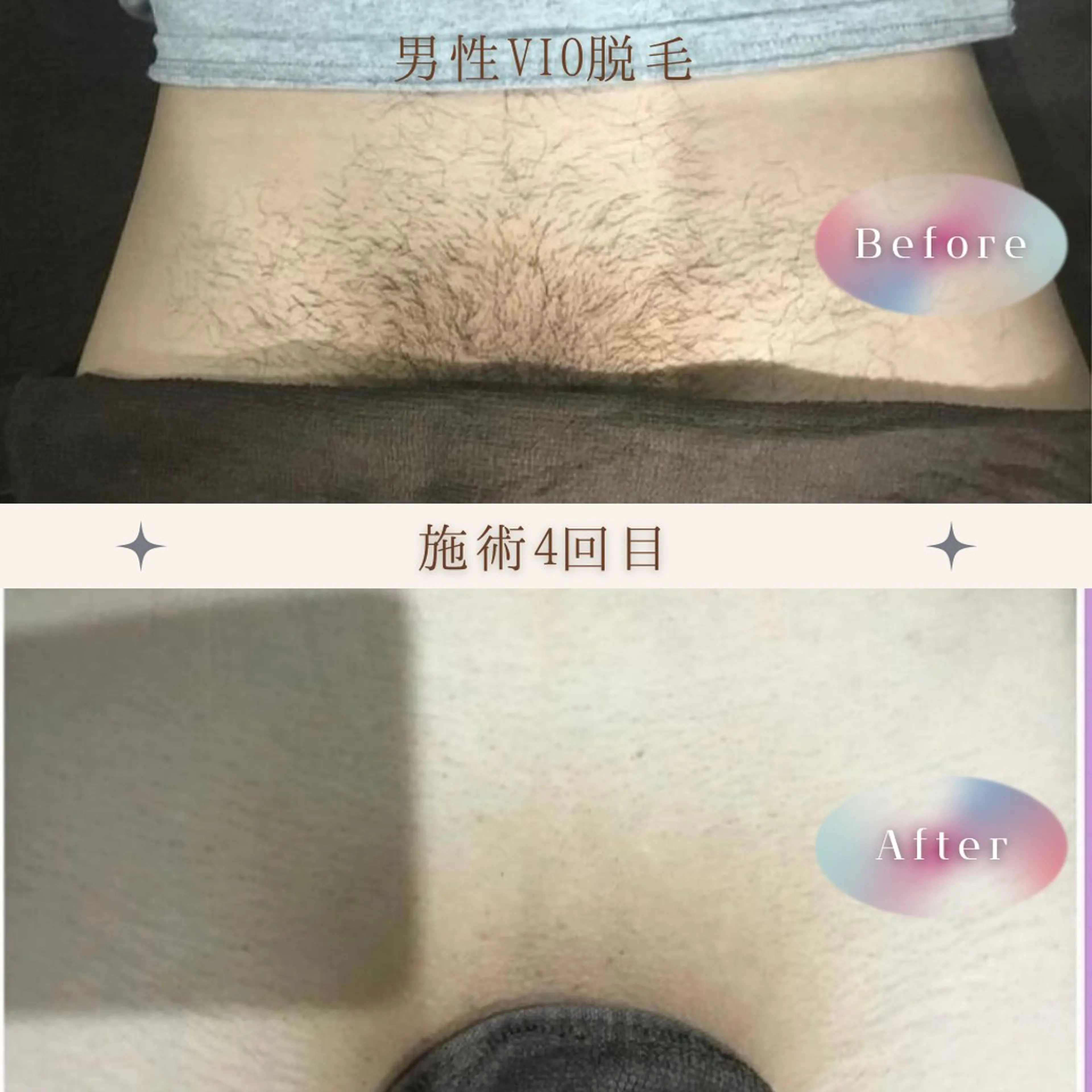 メンズ人気急上昇！V・I・Oからお好きなパーツを選択！✴️メンズ限定初回価格の写真