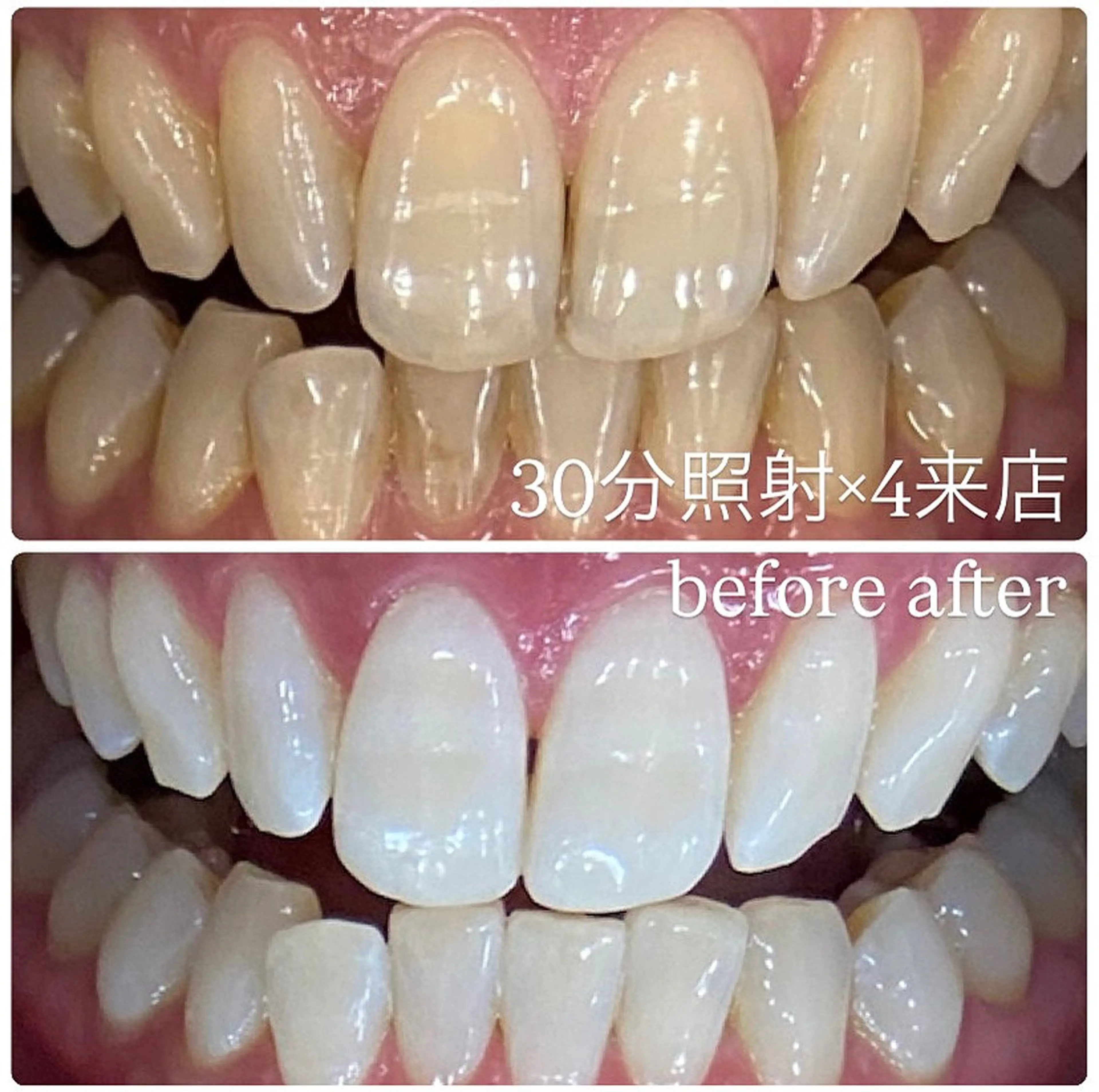 PLATINUM Beauty 横浜店所属・ホワイトニングルーム 横浜店のその他イメージ